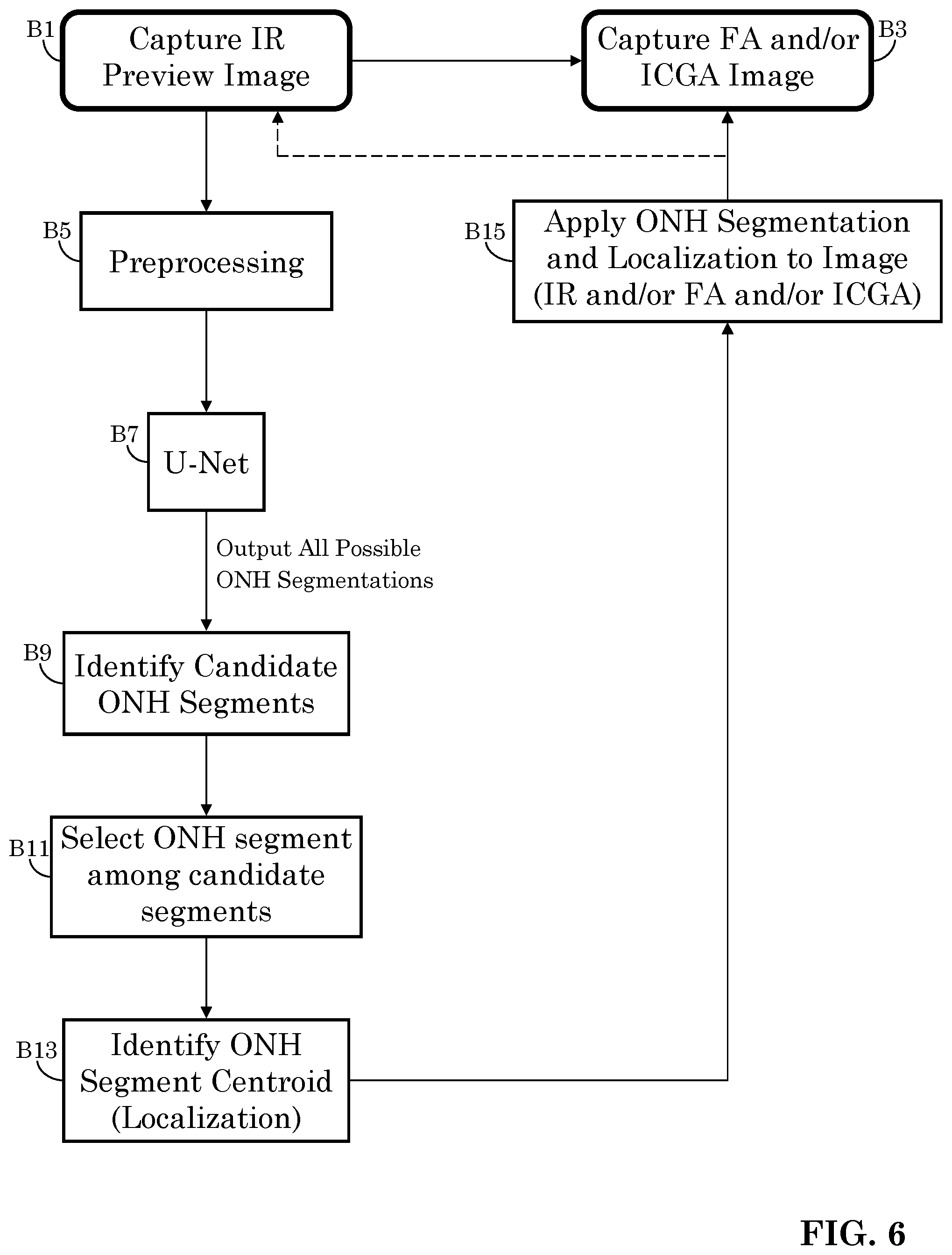 Patent US12303197 Figure 4 – Patient tuned ophthalmic imaging system with single exposure multi-type imaging, improved focusing, and improved angiography image sequence display