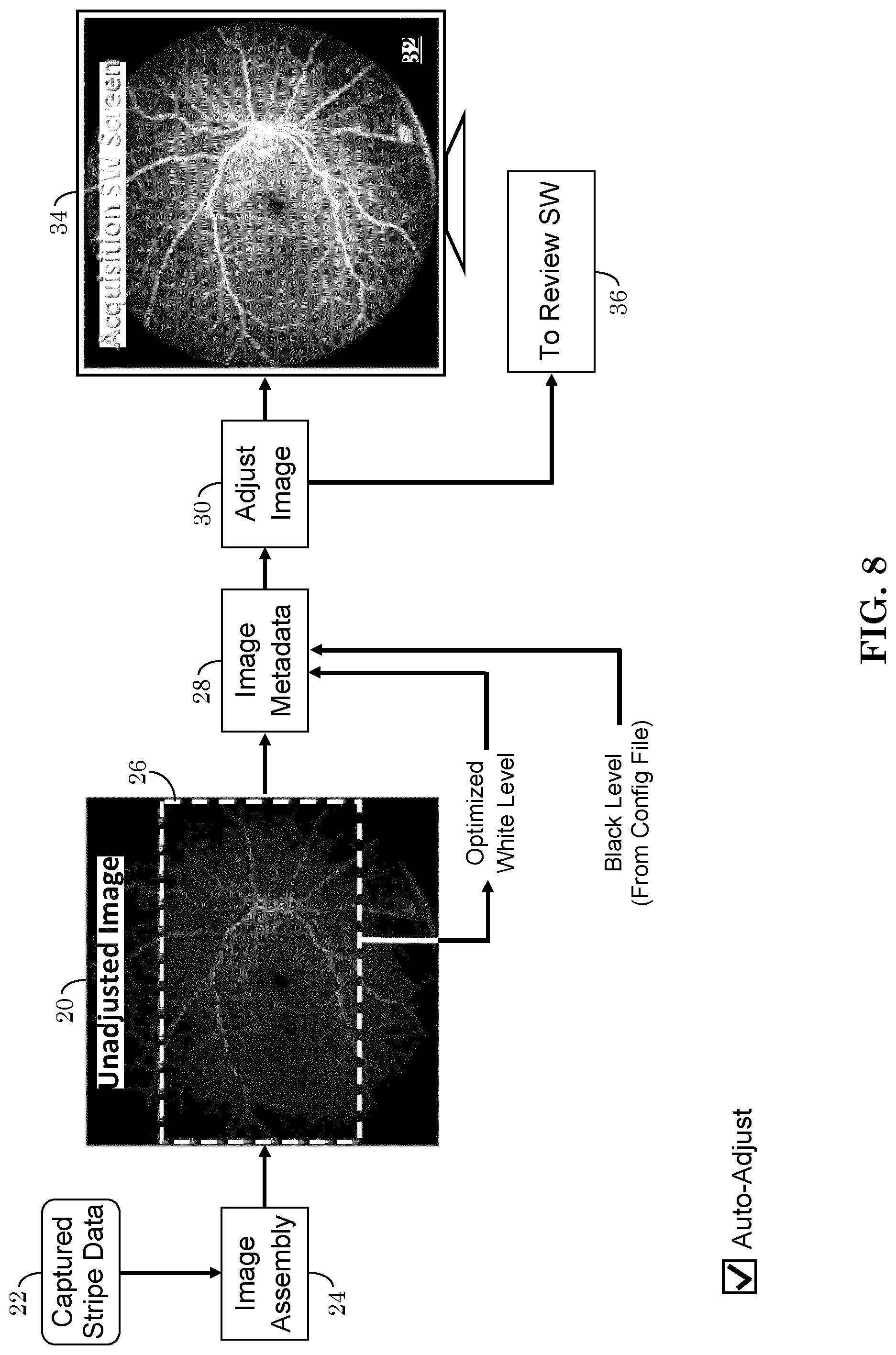 Patent US12303197 Figure 5 – Patient tuned ophthalmic imaging system with single exposure multi-type imaging, improved focusing, and improved angiography image sequence display