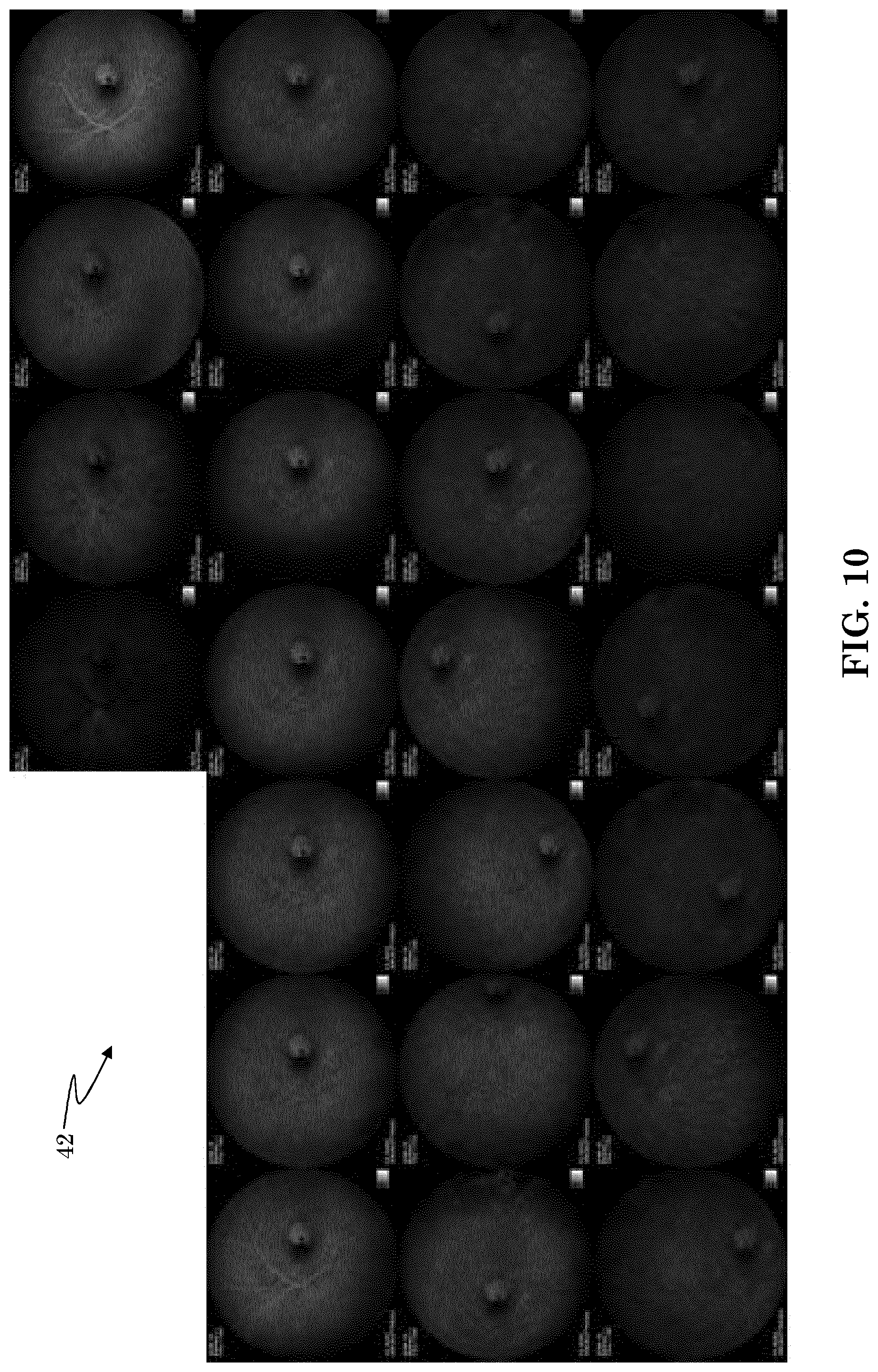 Patent US12303197 Figure 7 – Patient tuned ophthalmic imaging system with single exposure multi-type imaging, improved focusing, and improved angiography image sequence display