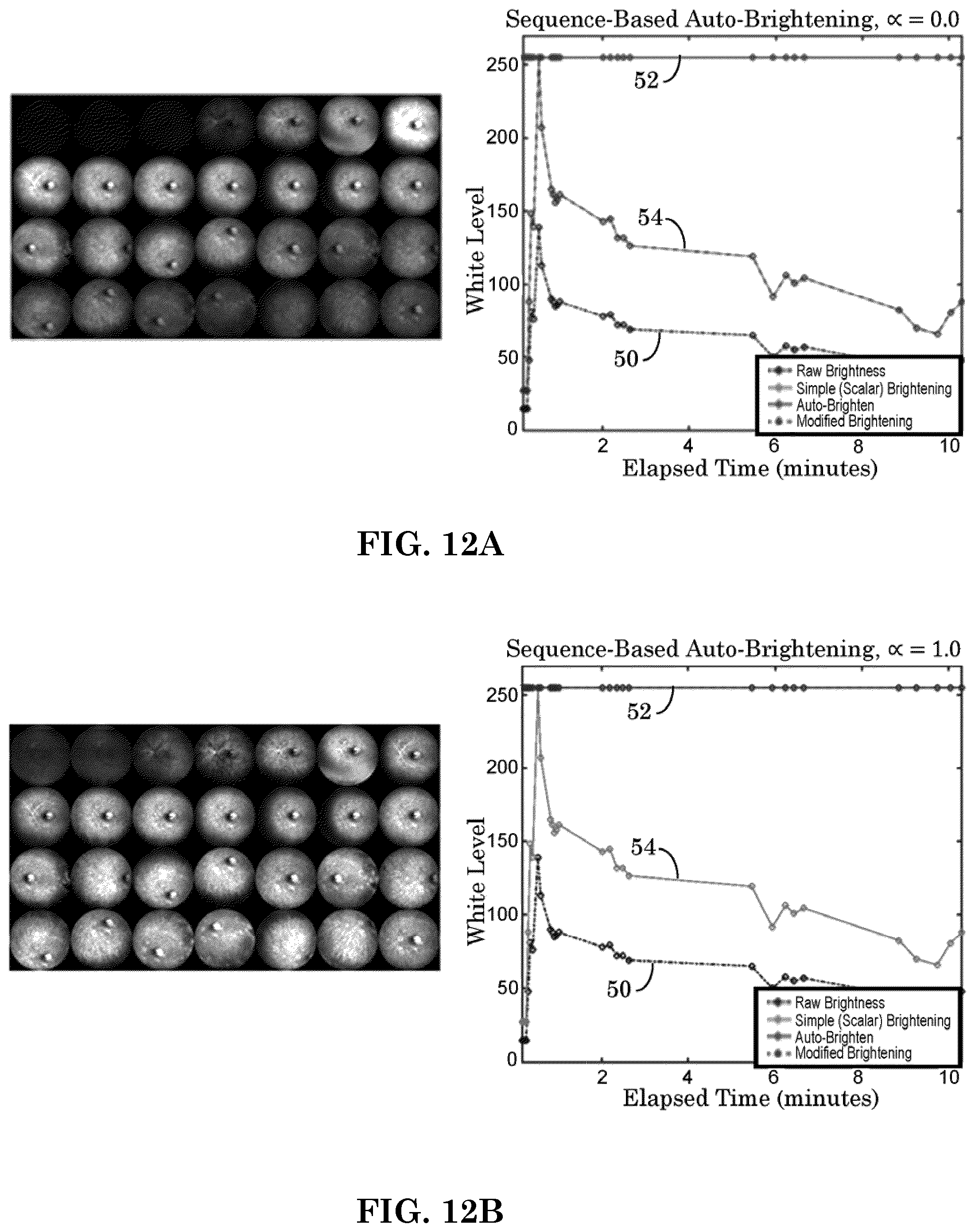 Patent US12303197 Figure 9 – Patient tuned ophthalmic imaging system with single exposure multi-type imaging, improved focusing, and improved angiography image sequence display
