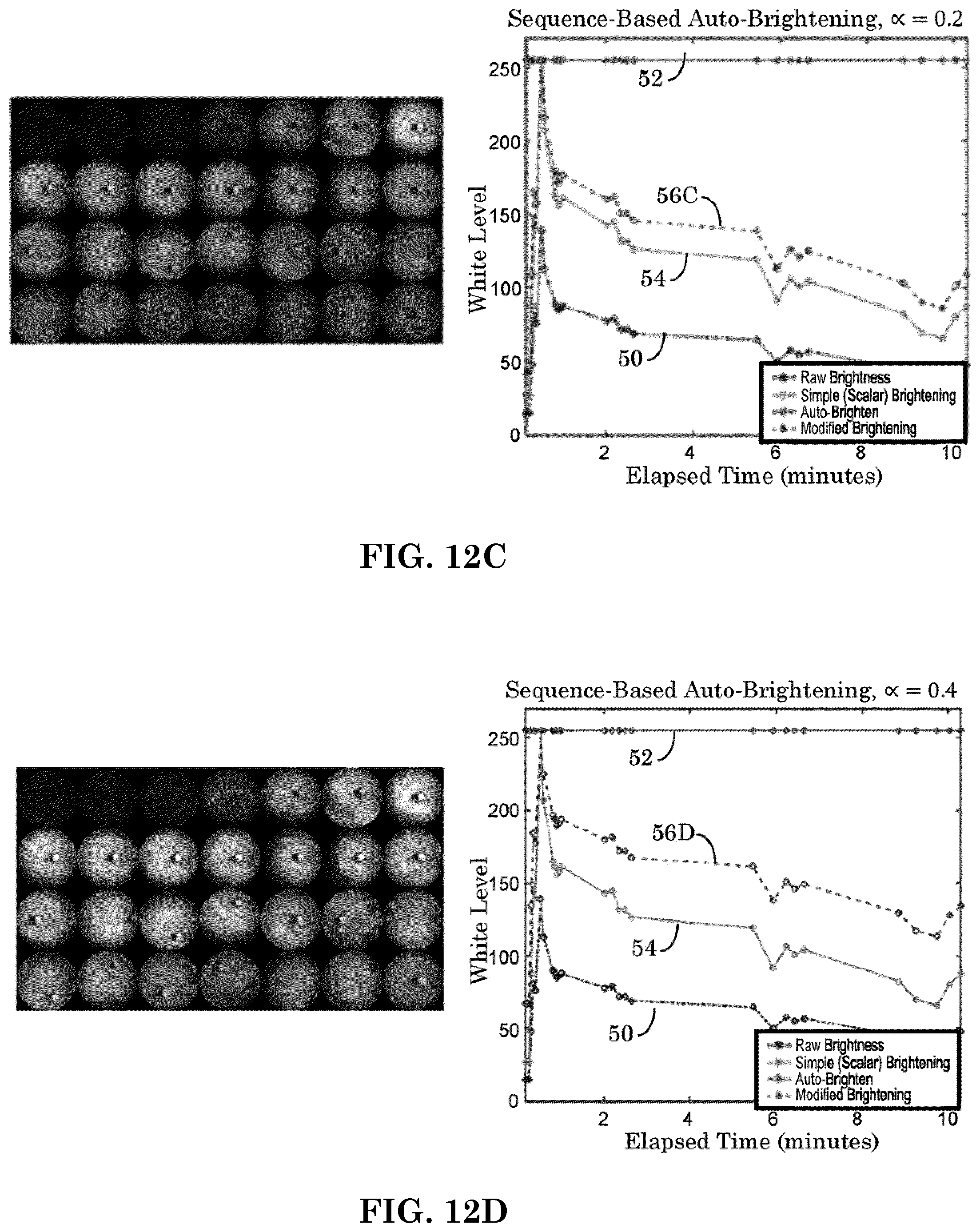 Patent US12303197 Figure 10 – Patient tuned ophthalmic imaging system with single exposure multi-type imaging, improved focusing, and improved angiography image sequence display