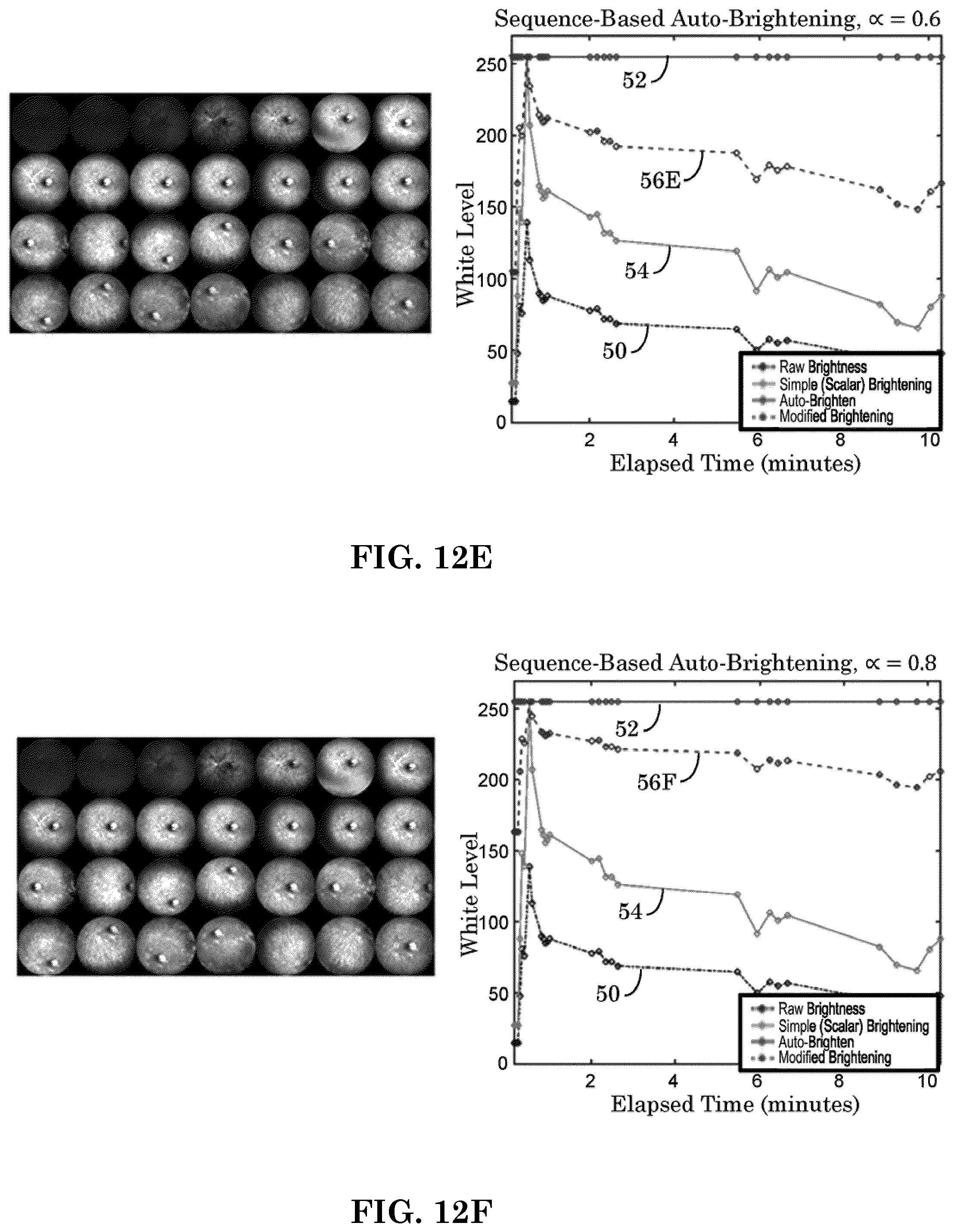 Patent US12303197 Figure 11 – Patient tuned ophthalmic imaging system with single exposure multi-type imaging, improved focusing, and improved angiography image sequence display