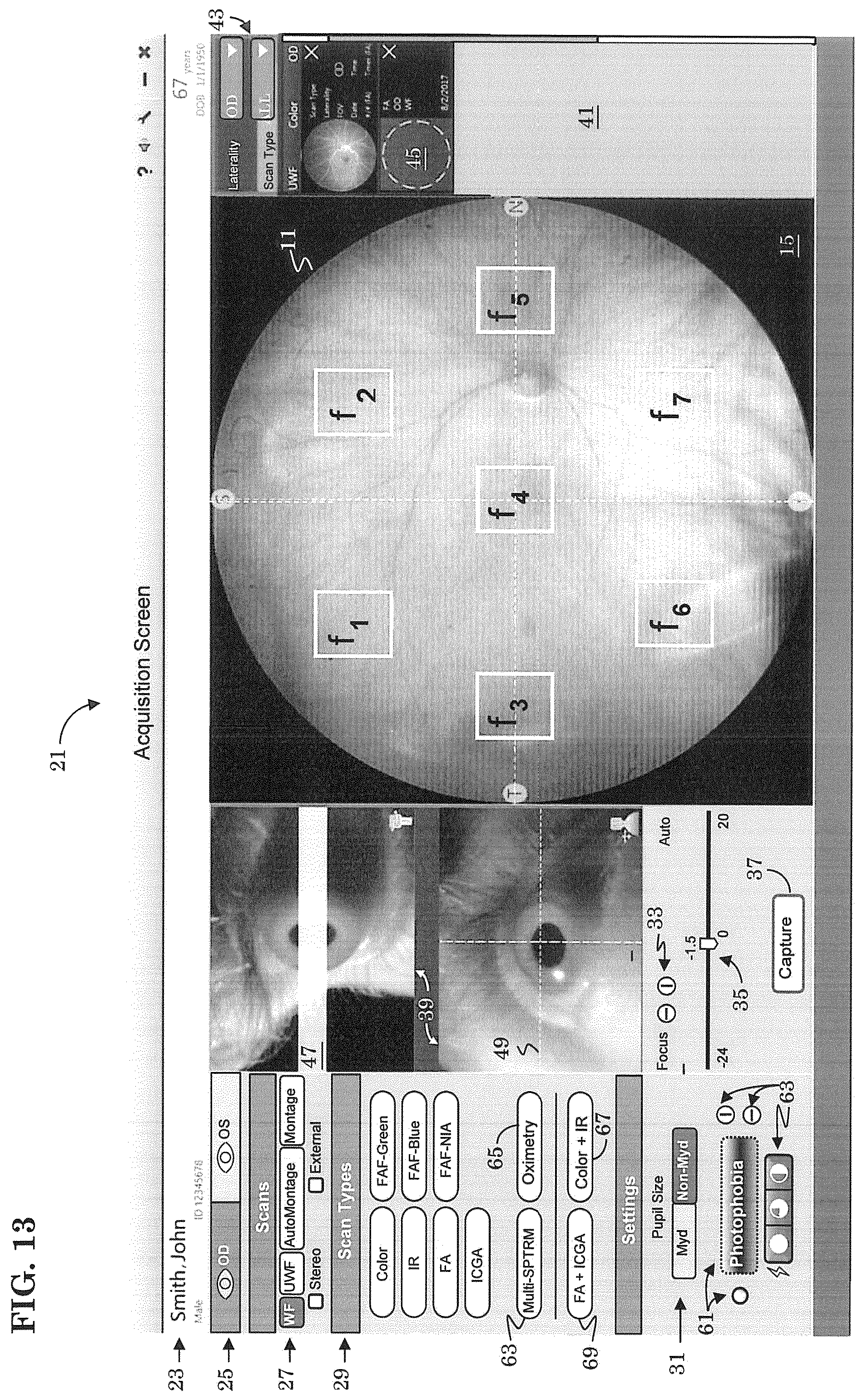 Patent US12303197 Figure 12 – Patient tuned ophthalmic imaging system with single exposure multi-type imaging, improved focusing, and improved angiography image sequence display