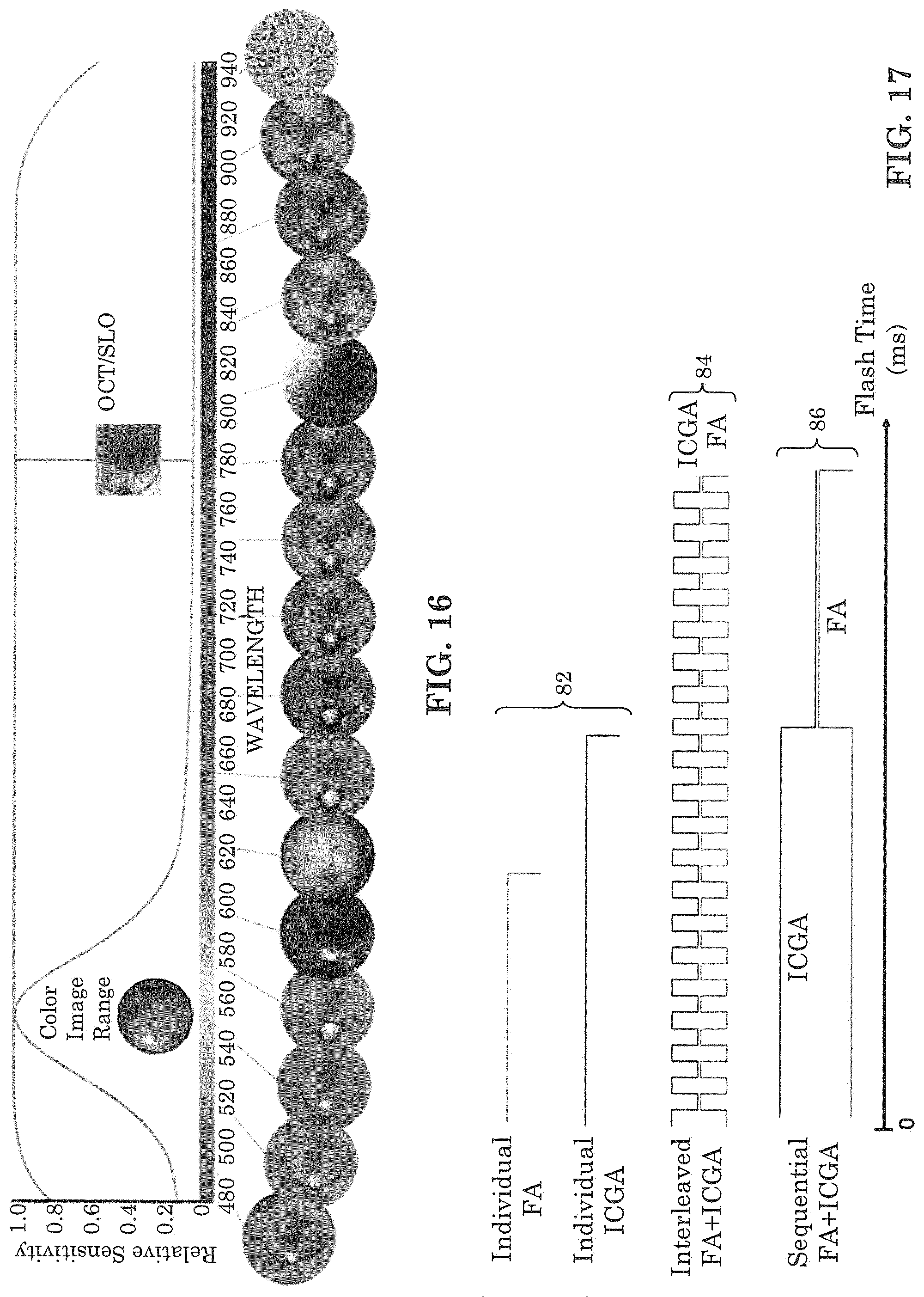 Patent US12303197 Figure 14 – Patient tuned ophthalmic imaging system with single exposure multi-type imaging, improved focusing, and improved angiography image sequence display