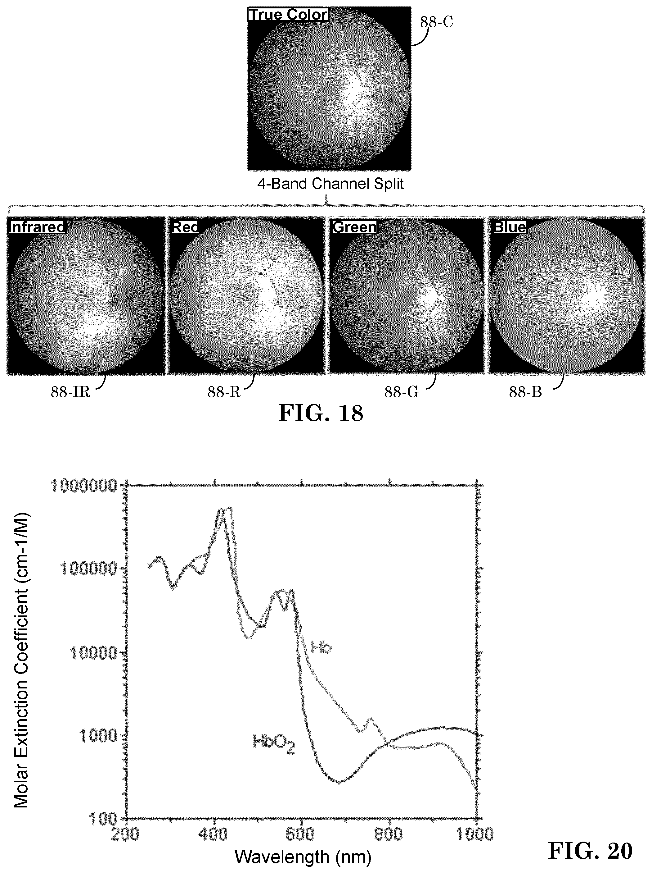 Patent US12303197 Figure 15 – Patient tuned ophthalmic imaging system with single exposure multi-type imaging, improved focusing, and improved angiography image sequence display