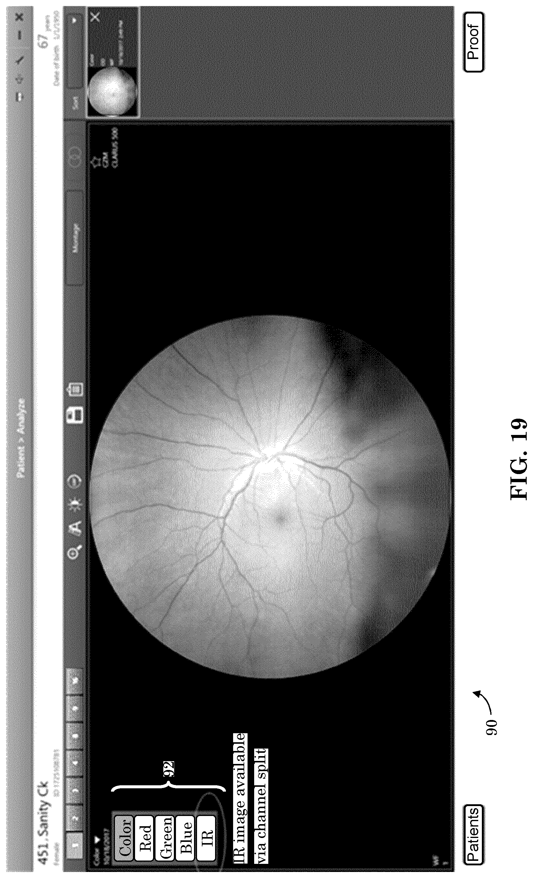 Patent US12303197 Figure 16 – Patient tuned ophthalmic imaging system with single exposure multi-type imaging, improved focusing, and improved angiography image sequence display