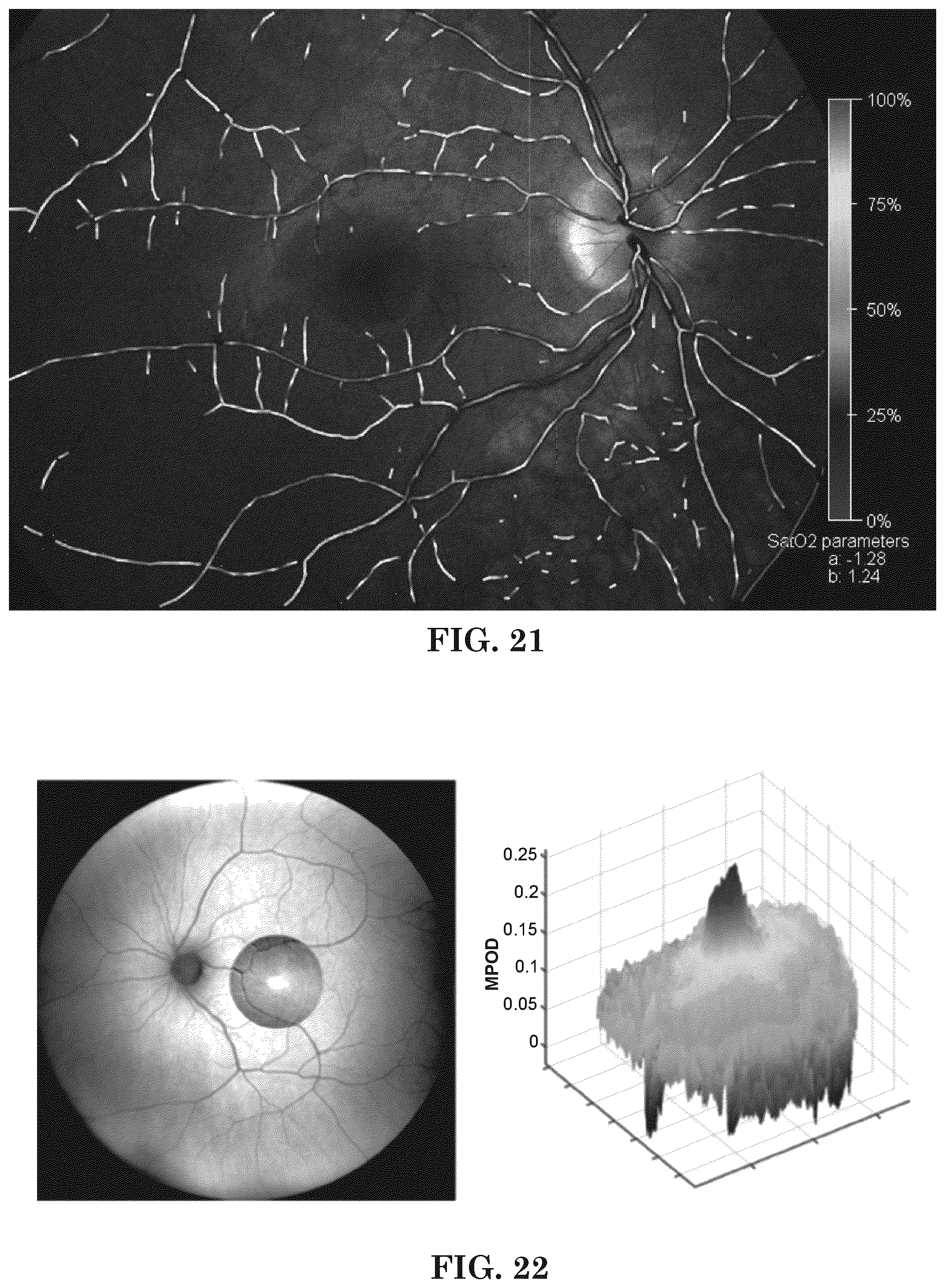 Patent US12303197 Figure 17 – Patient tuned ophthalmic imaging system with single exposure multi-type imaging, improved focusing, and improved angiography image sequence display
