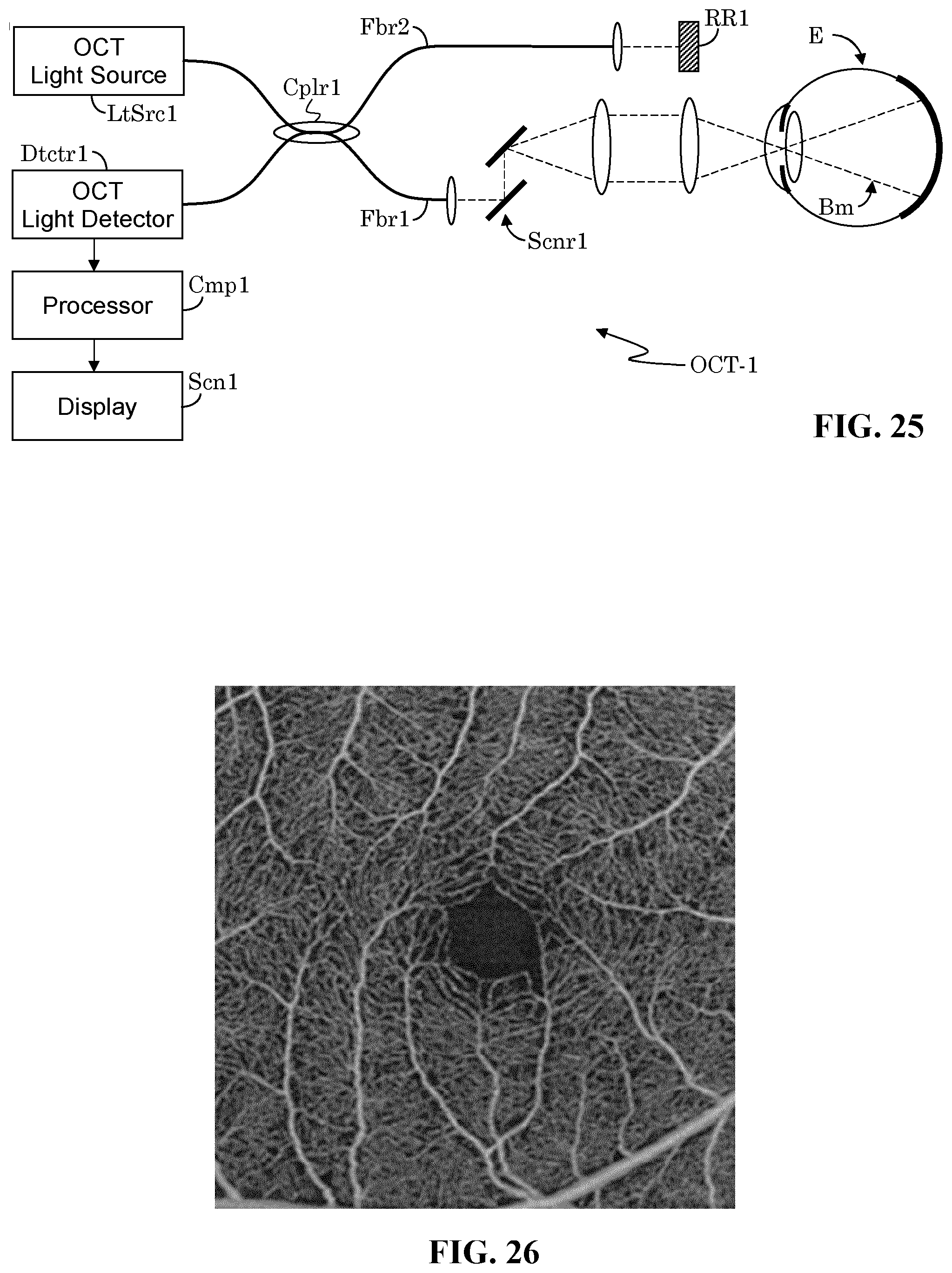 Patent US12303197 Figure 20 – Patient tuned ophthalmic imaging system with single exposure multi-type imaging, improved focusing, and improved angiography image sequence display