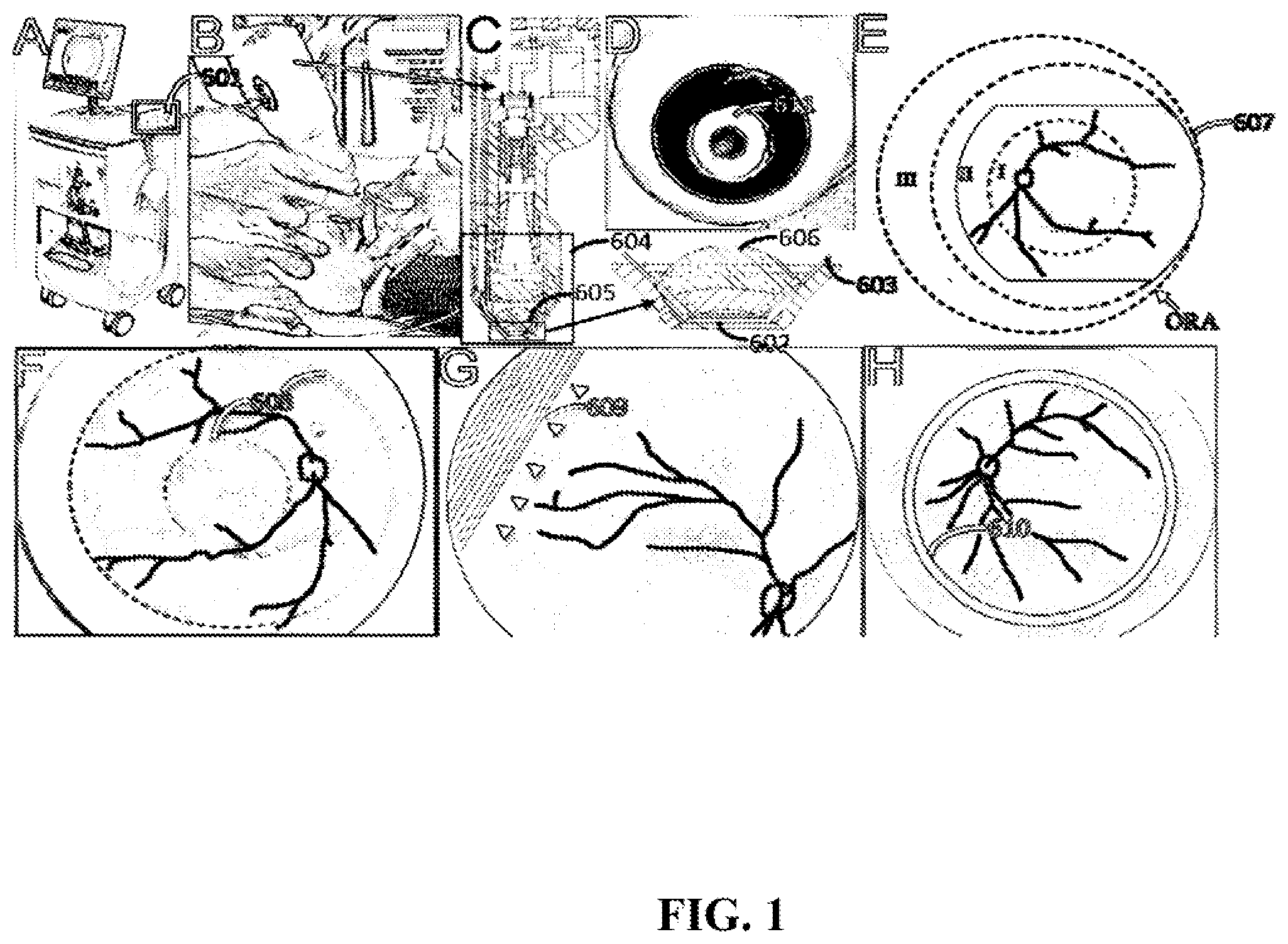 Patent US12303199 Figure 1 – Wide field fundus camera