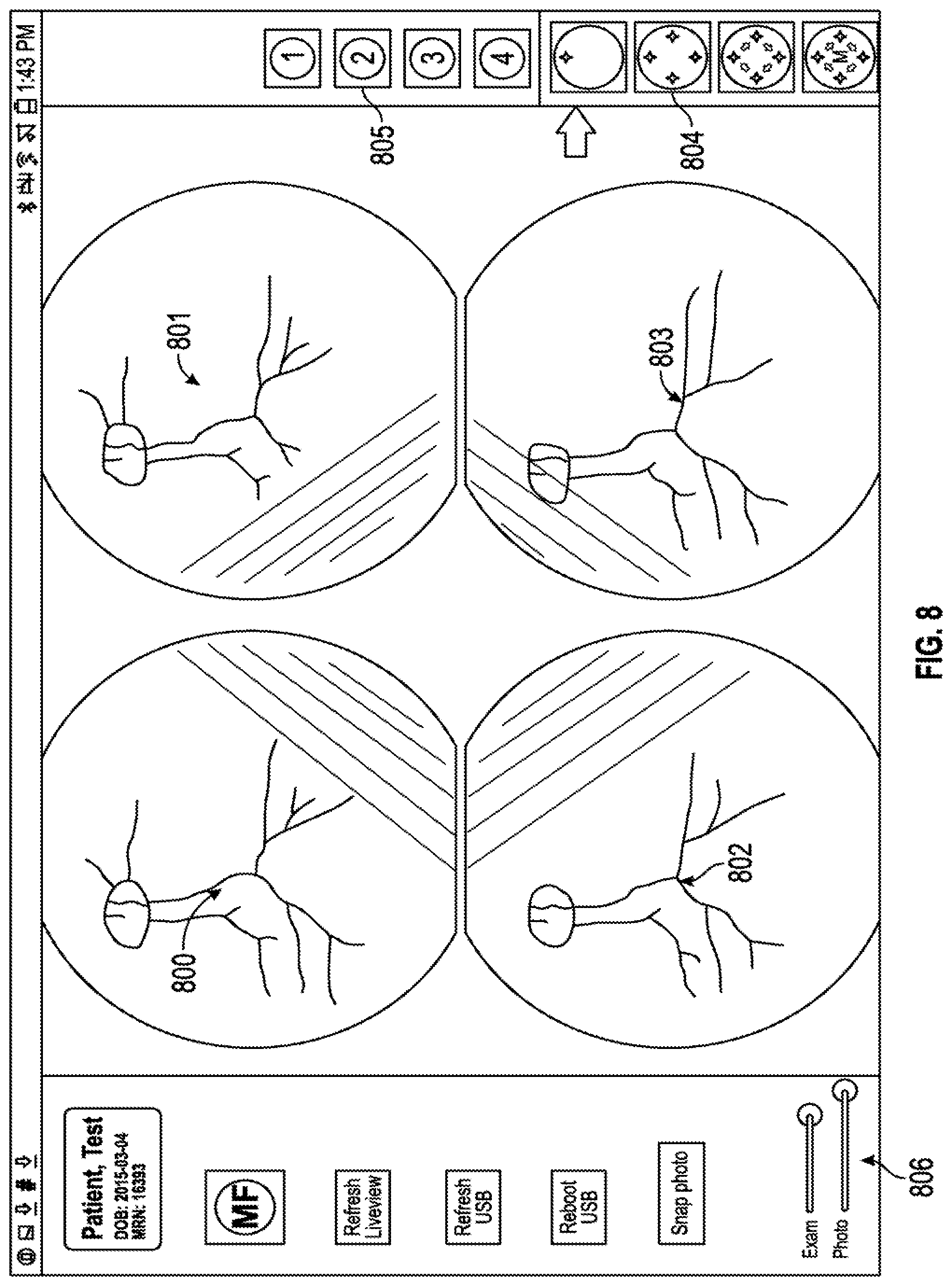 Patent US12303199 Figure 8 – Wide field fundus camera