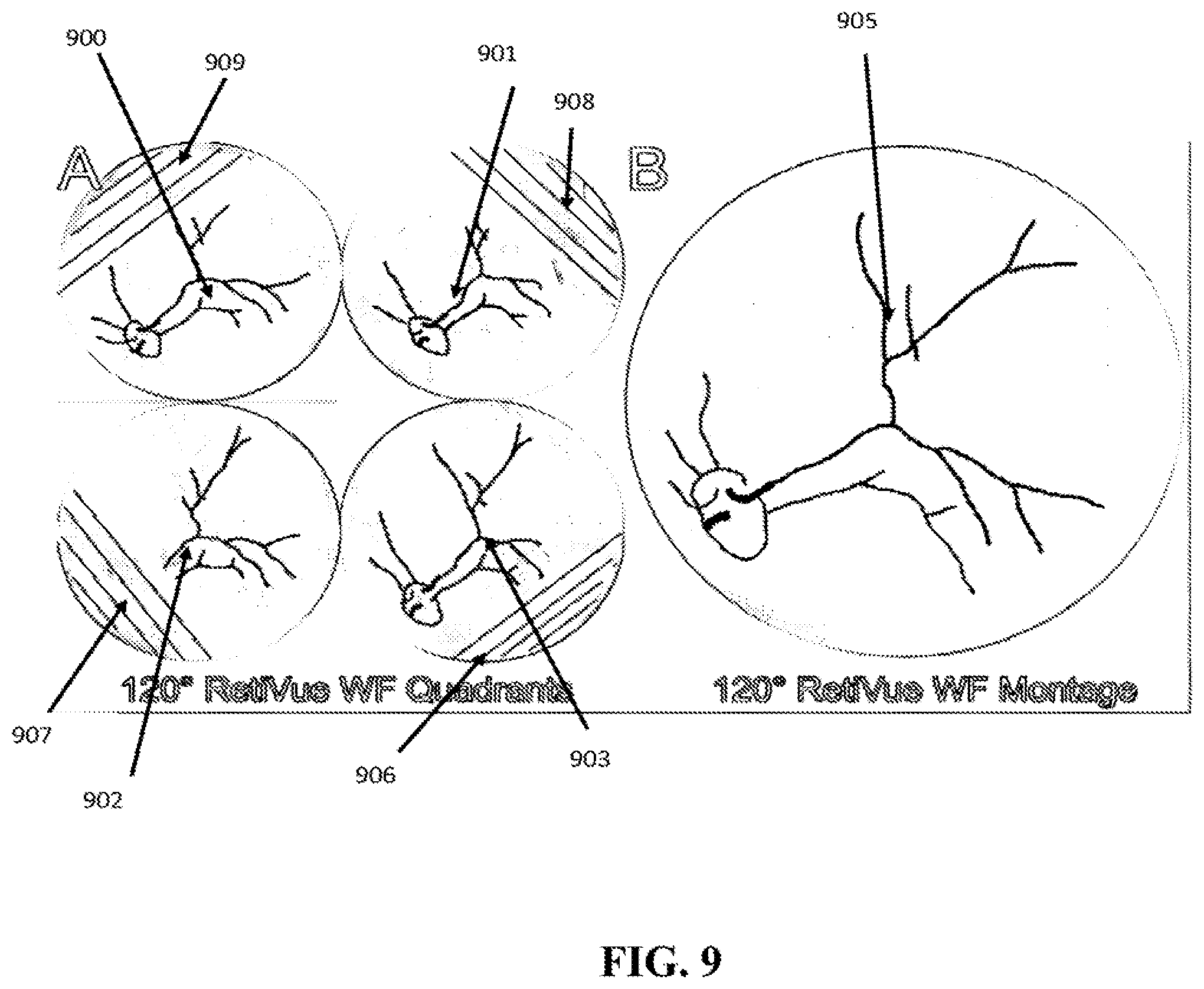 Patent US12303199 Figure 9 – Wide field fundus camera