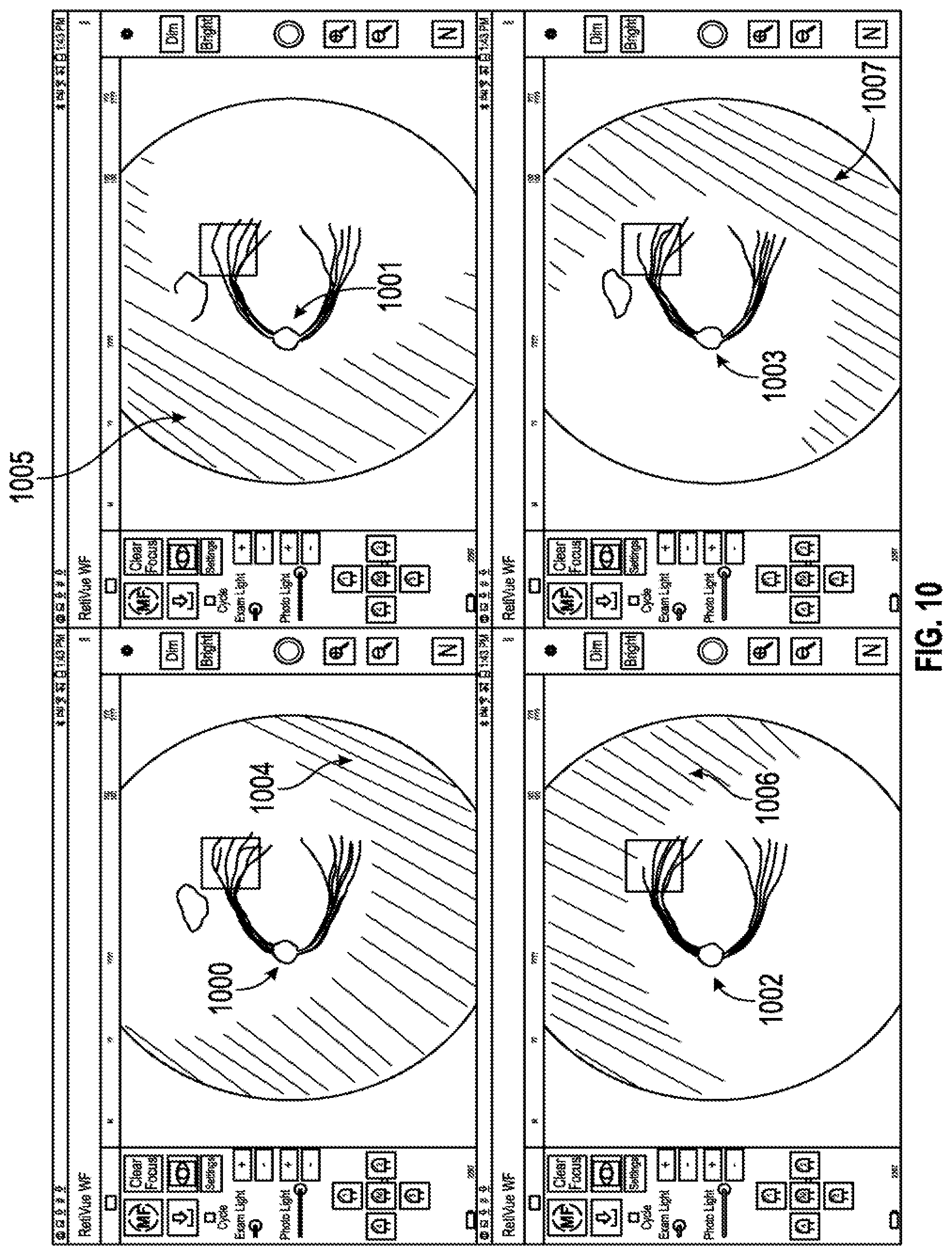 Patent US12303199 Figure 10 – Wide field fundus camera