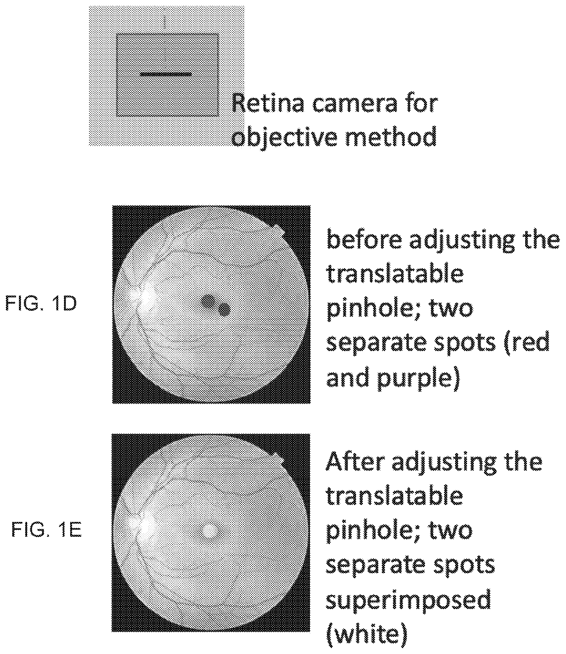 Patent US12303202 Figure 3 – Method and apparatus for locating the visual axis on the surface of the cornea