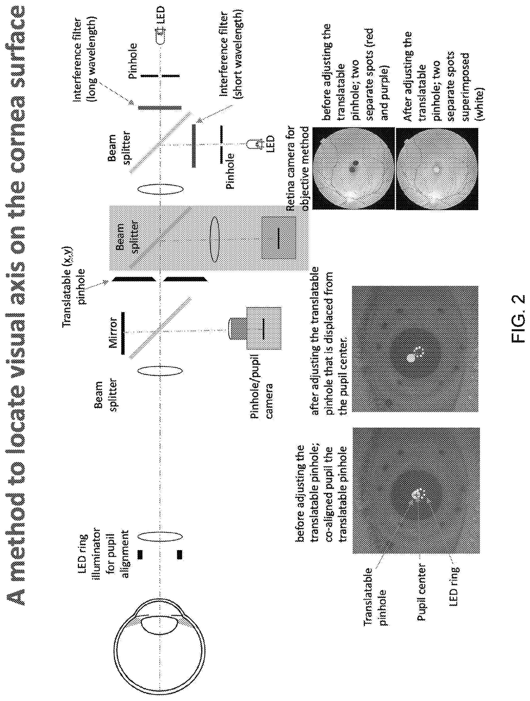 Patent US12303202 Figure 4 – Method and apparatus for locating the visual axis on the surface of the cornea
