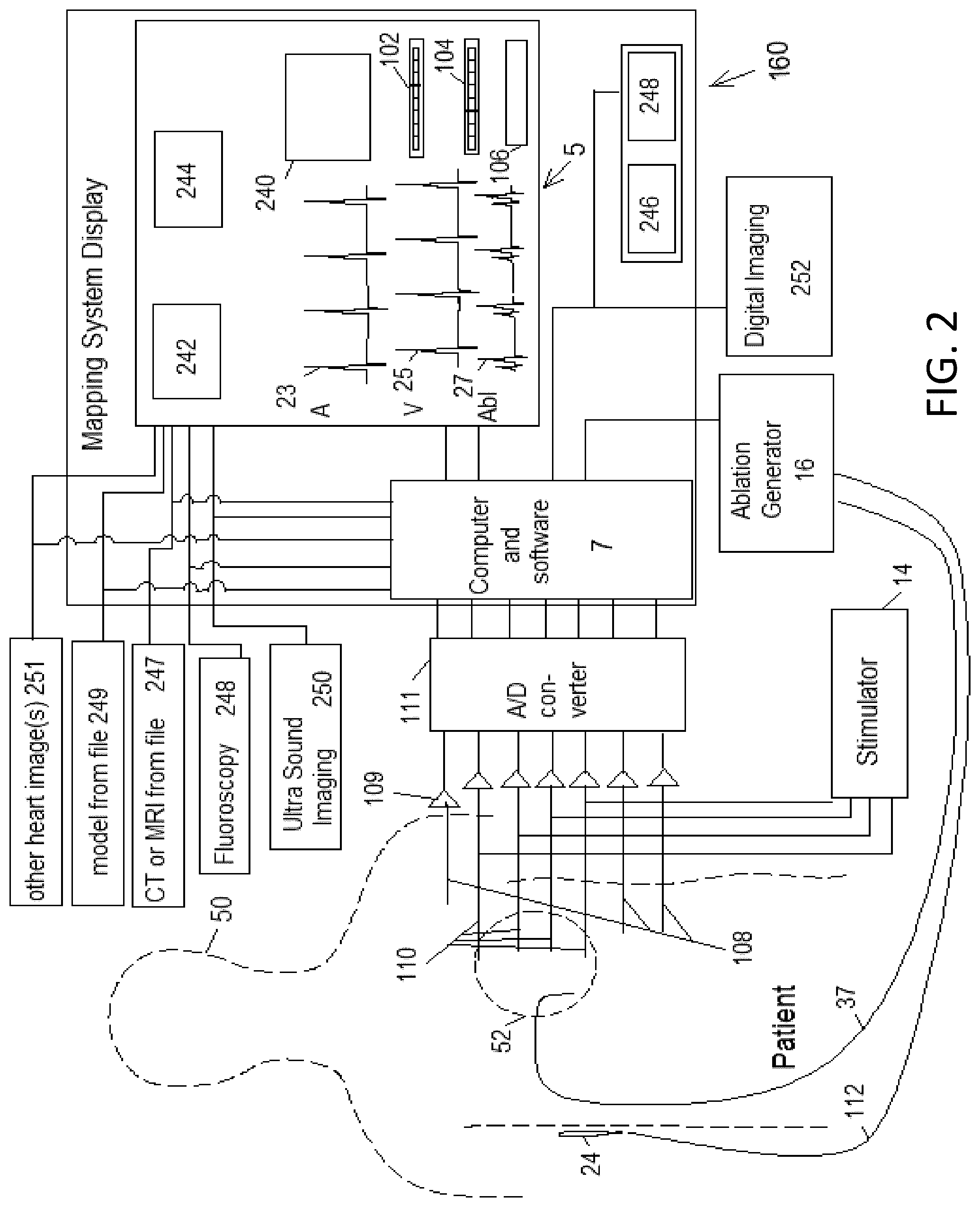 Patent US12303203 Figure 3 – Methods and system for atrial fibrillation ablation using balloon based catheters and utilizing medical images (CT or MRI in segments) based cardiac mapping and/or utilizing virtual reality (VR), and/or augmented reality (AR), and/or mixed reality (MR) for aiding in cardiac procedures