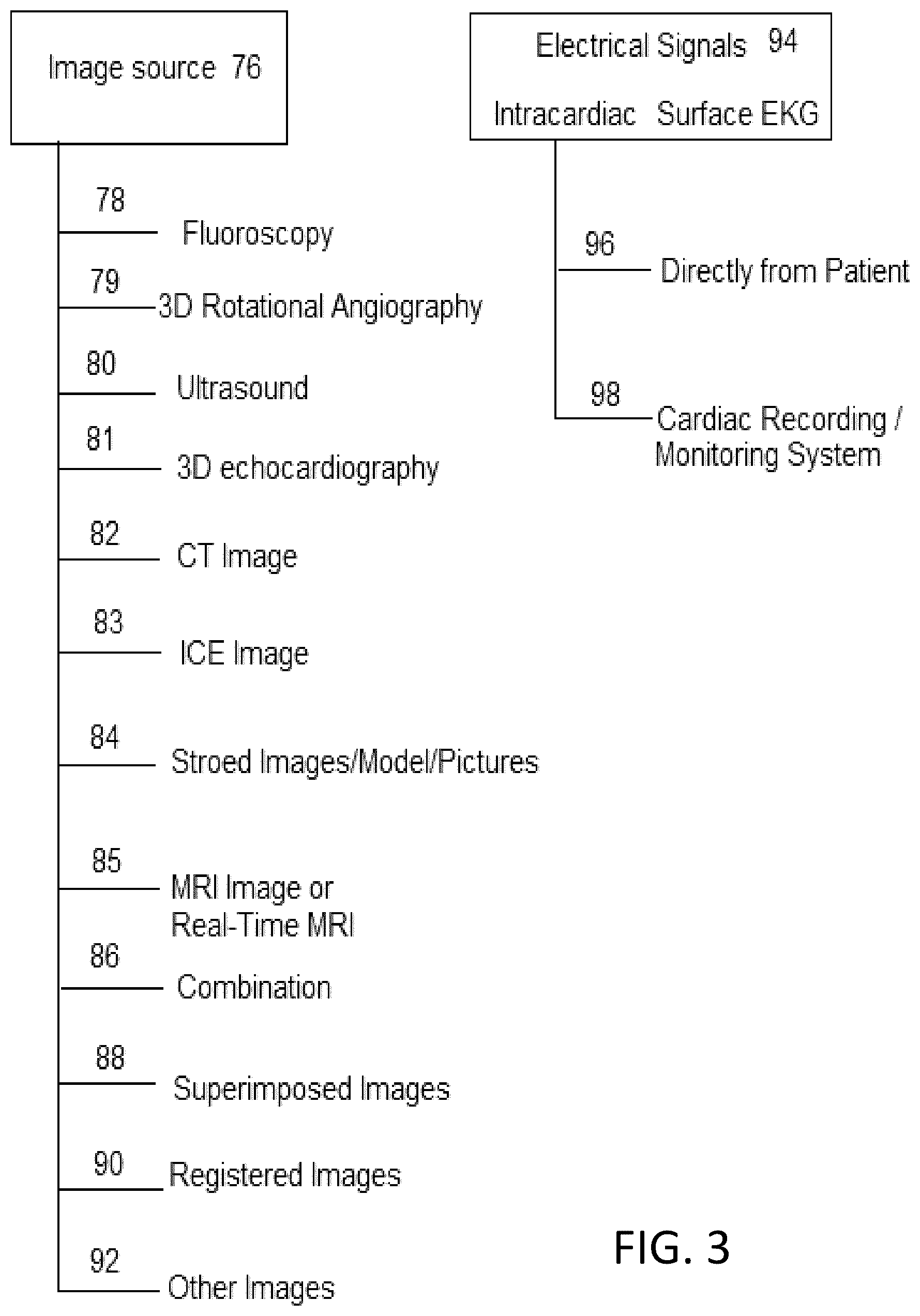 Patent US12303203 Figure 4 – Methods and system for atrial fibrillation ablation using balloon based catheters and utilizing medical images (CT or MRI in segments) based cardiac mapping and/or utilizing virtual reality (VR), and/or augmented reality (AR), and/or mixed reality (MR) for aiding in cardiac procedures