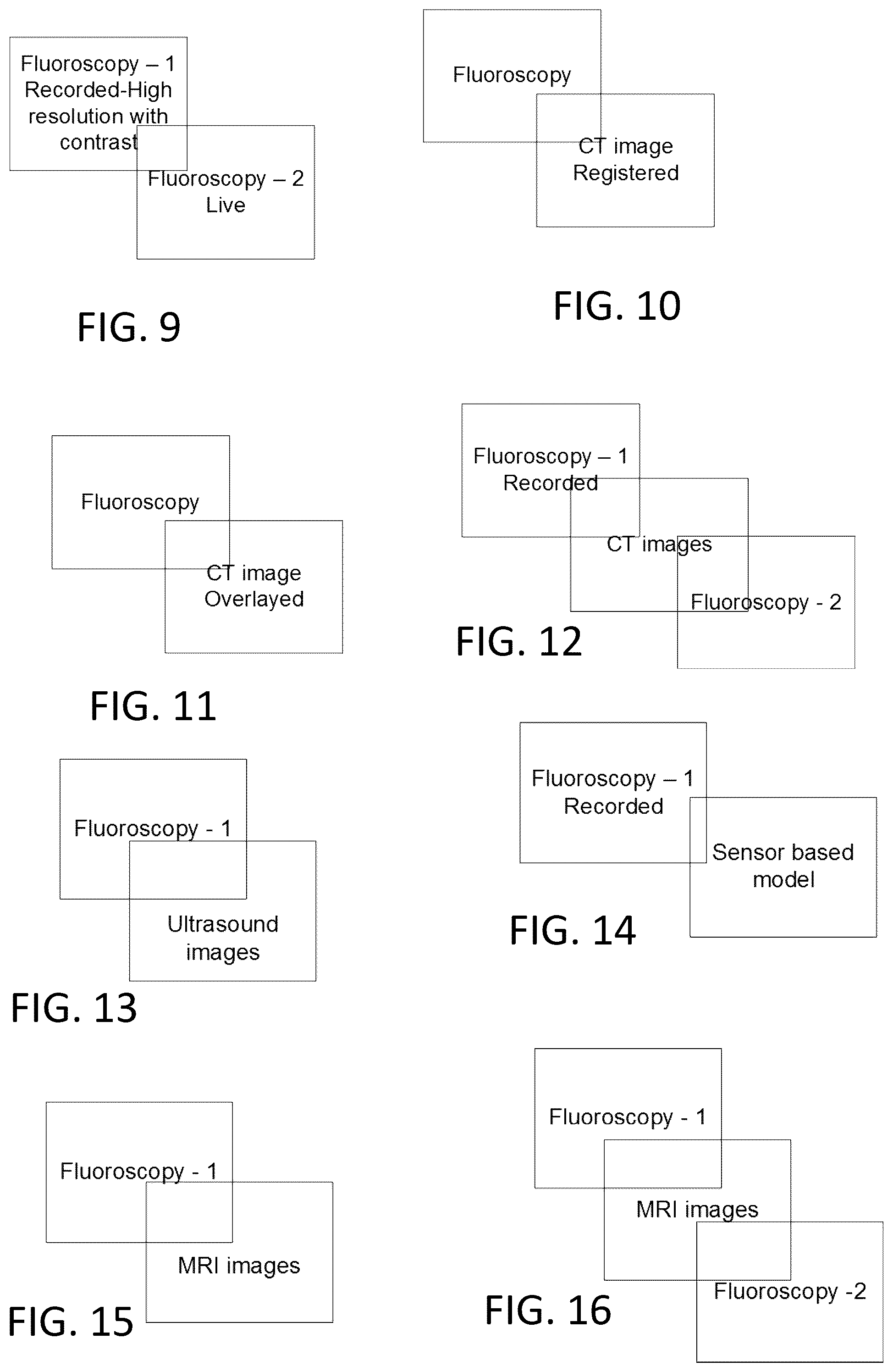 Patent US12303203 Figure 8 – Methods and system for atrial fibrillation ablation using balloon based catheters and utilizing medical images (CT or MRI in segments) based cardiac mapping and/or utilizing virtual reality (VR), and/or augmented reality (AR), and/or mixed reality (MR) for aiding in cardiac procedures