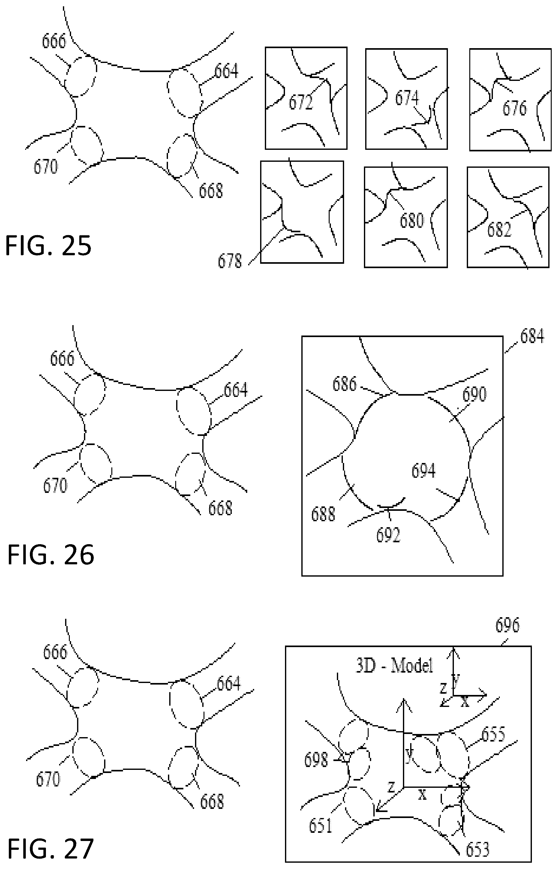 Patent US12303203 Figure 13 – Methods and system for atrial fibrillation ablation using balloon based catheters and utilizing medical images (CT or MRI in segments) based cardiac mapping and/or utilizing virtual reality (VR), and/or augmented reality (AR), and/or mixed reality (MR) for aiding in cardiac procedures