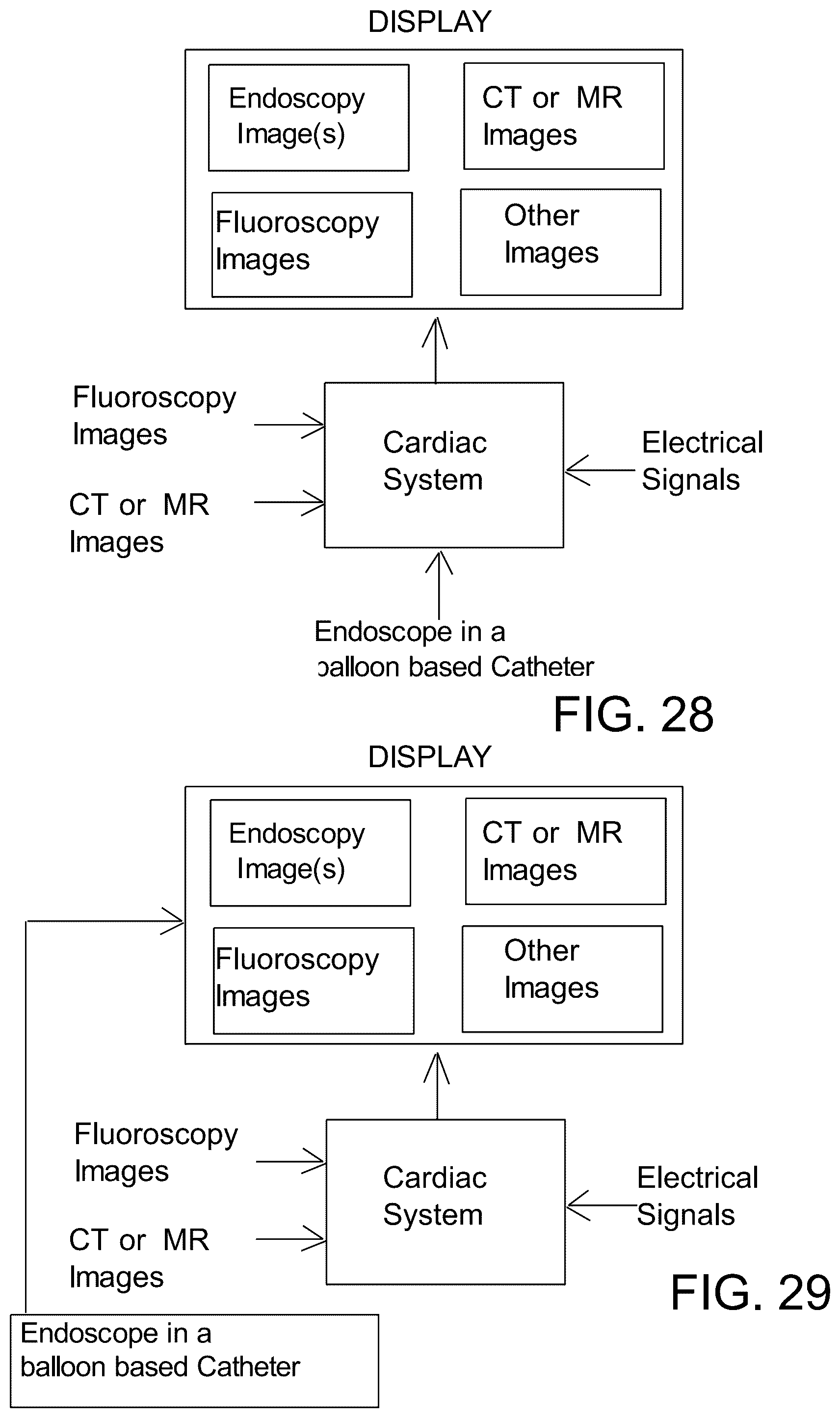 Patent US12303203 Figure 14 – Methods and system for atrial fibrillation ablation using balloon based catheters and utilizing medical images (CT or MRI in segments) based cardiac mapping and/or utilizing virtual reality (VR), and/or augmented reality (AR), and/or mixed reality (MR) for aiding in cardiac procedures