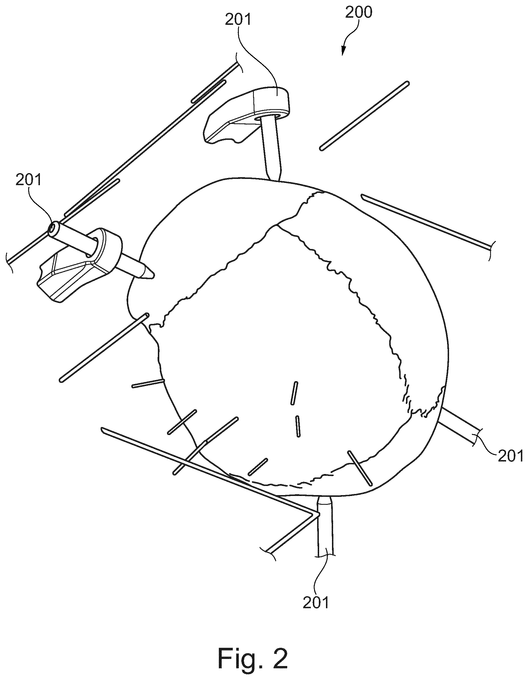Patent US12303204 Figure 2 – Automated pre-operative assessment of implant placement in human bone