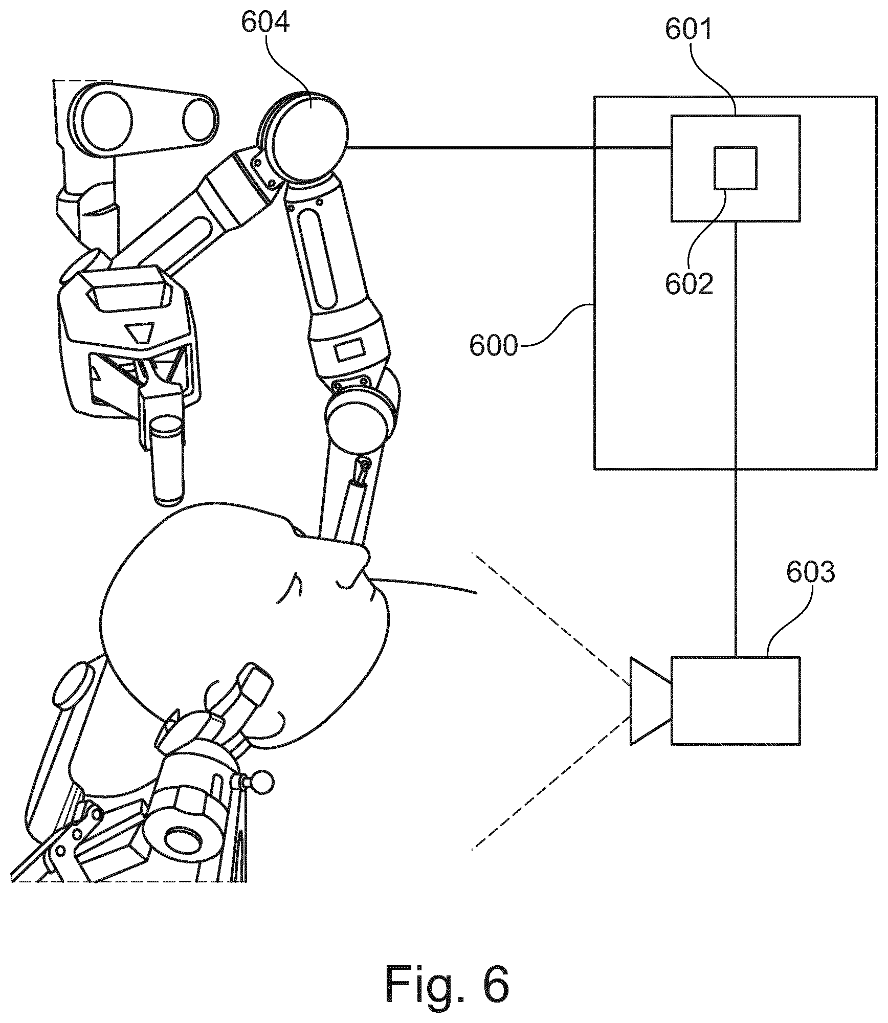Patent US12303204 Figure 6 – Automated pre-operative assessment of implant placement in human bone