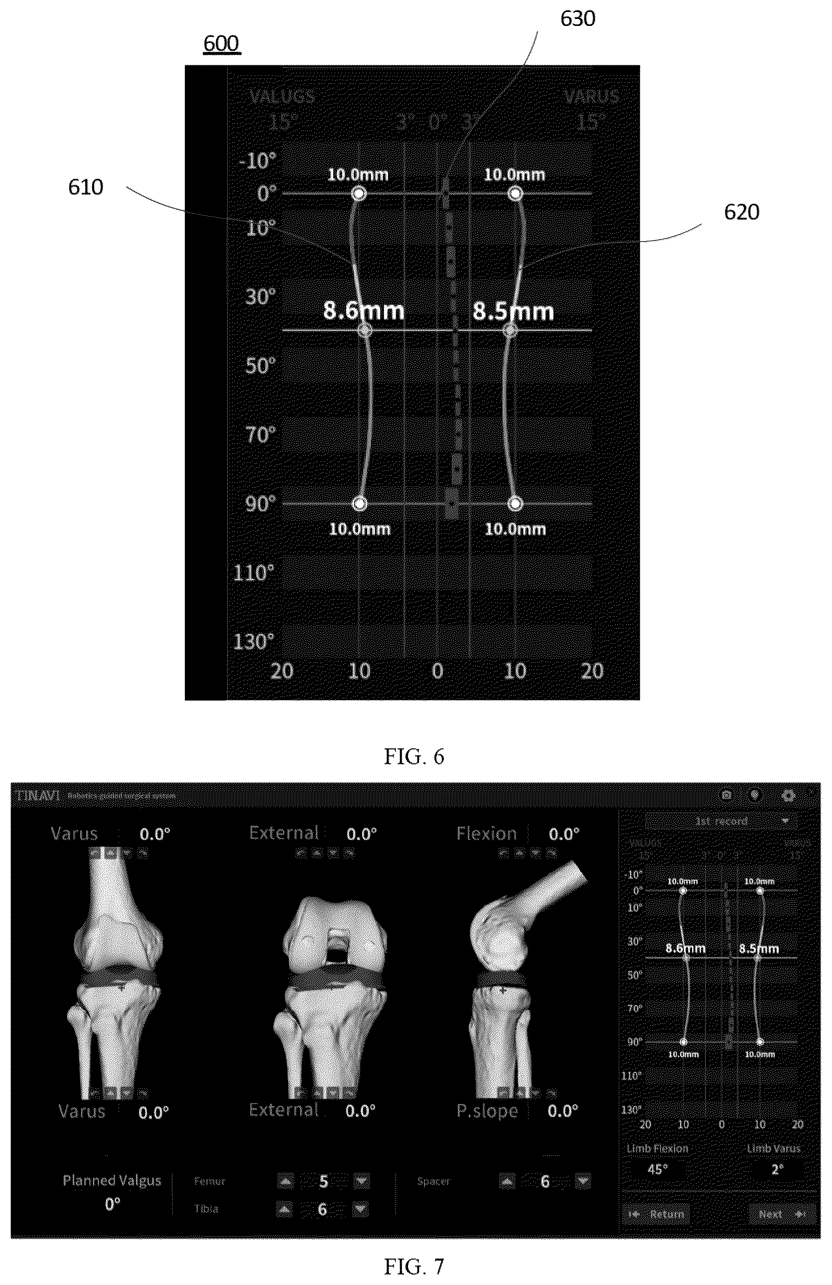 Patent US12303205 Figure 4 – TKA intraoperative planning adjustment method, apparatus and device for TKA