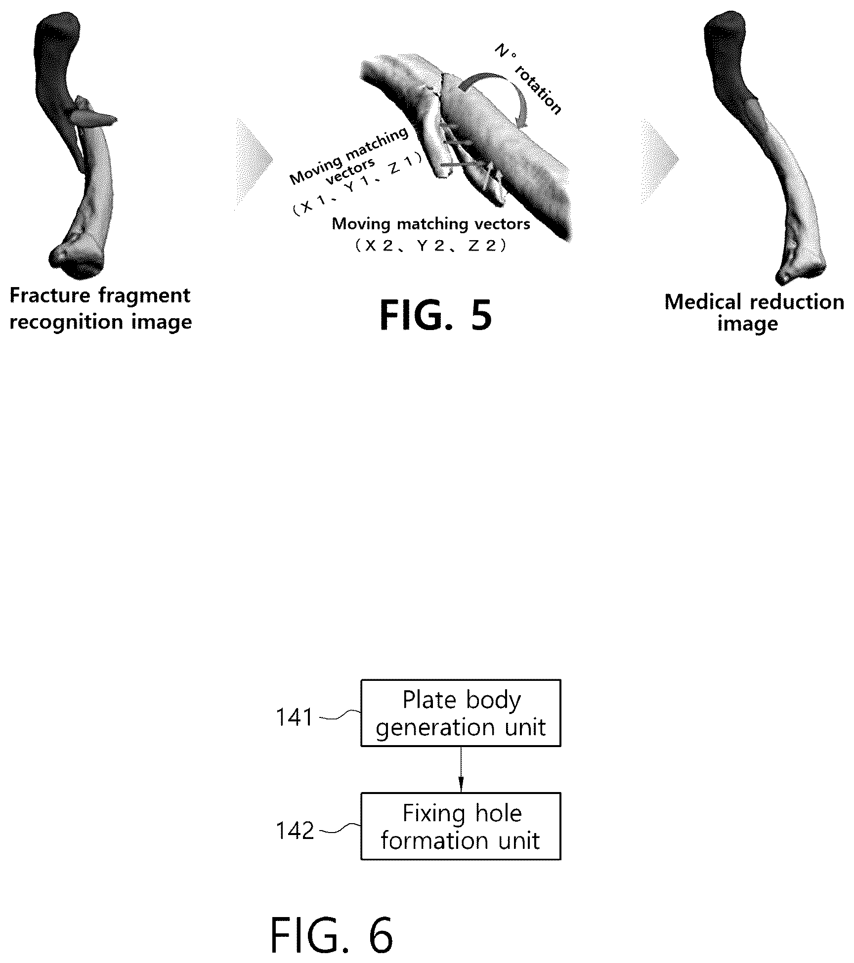 Patent US12303206 Figure 3 – Method and apparatus for generating virtual internal fixture on basis of image reduction