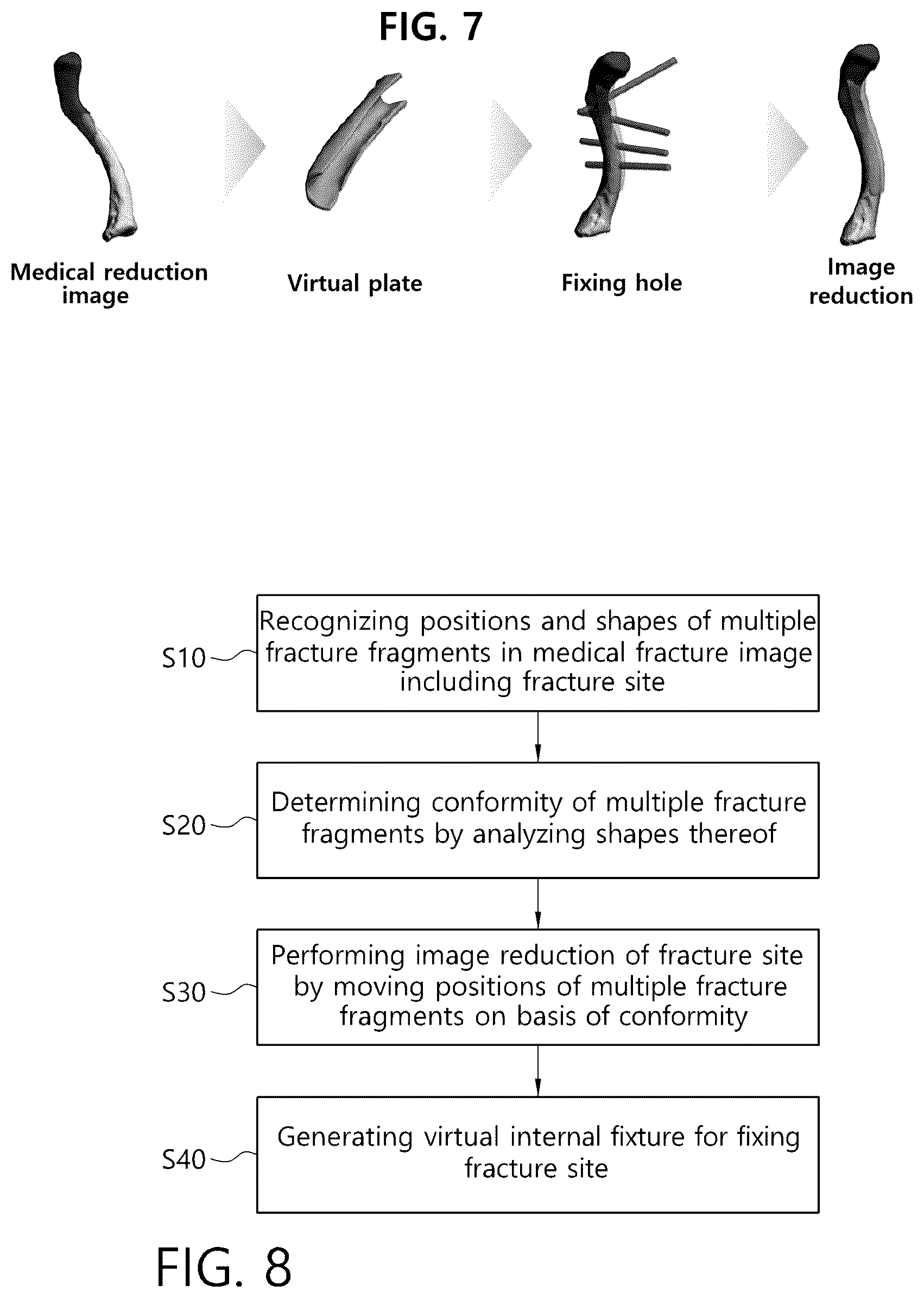 Patent US12303206 Figure 4 – Method and apparatus for generating virtual internal fixture on basis of image reduction