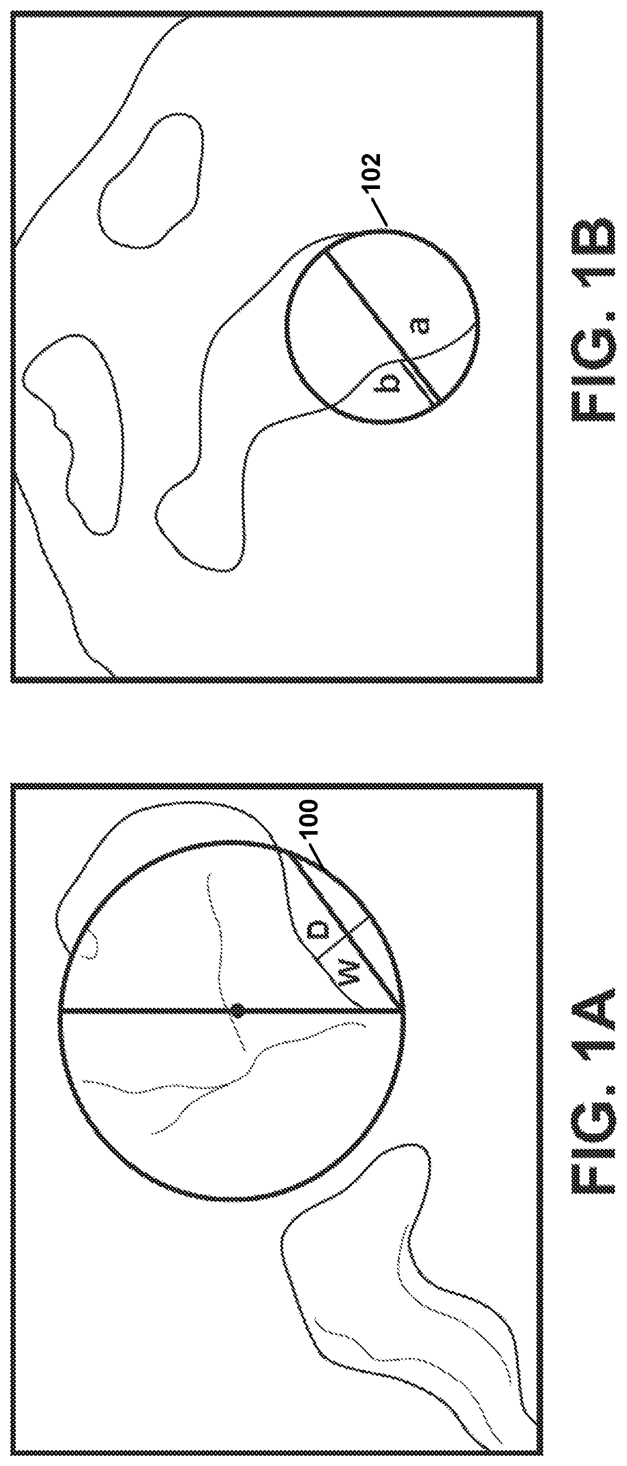 Patent US12303207 Figure 1 – Automated planning of shoulder stability enhancement surgeries