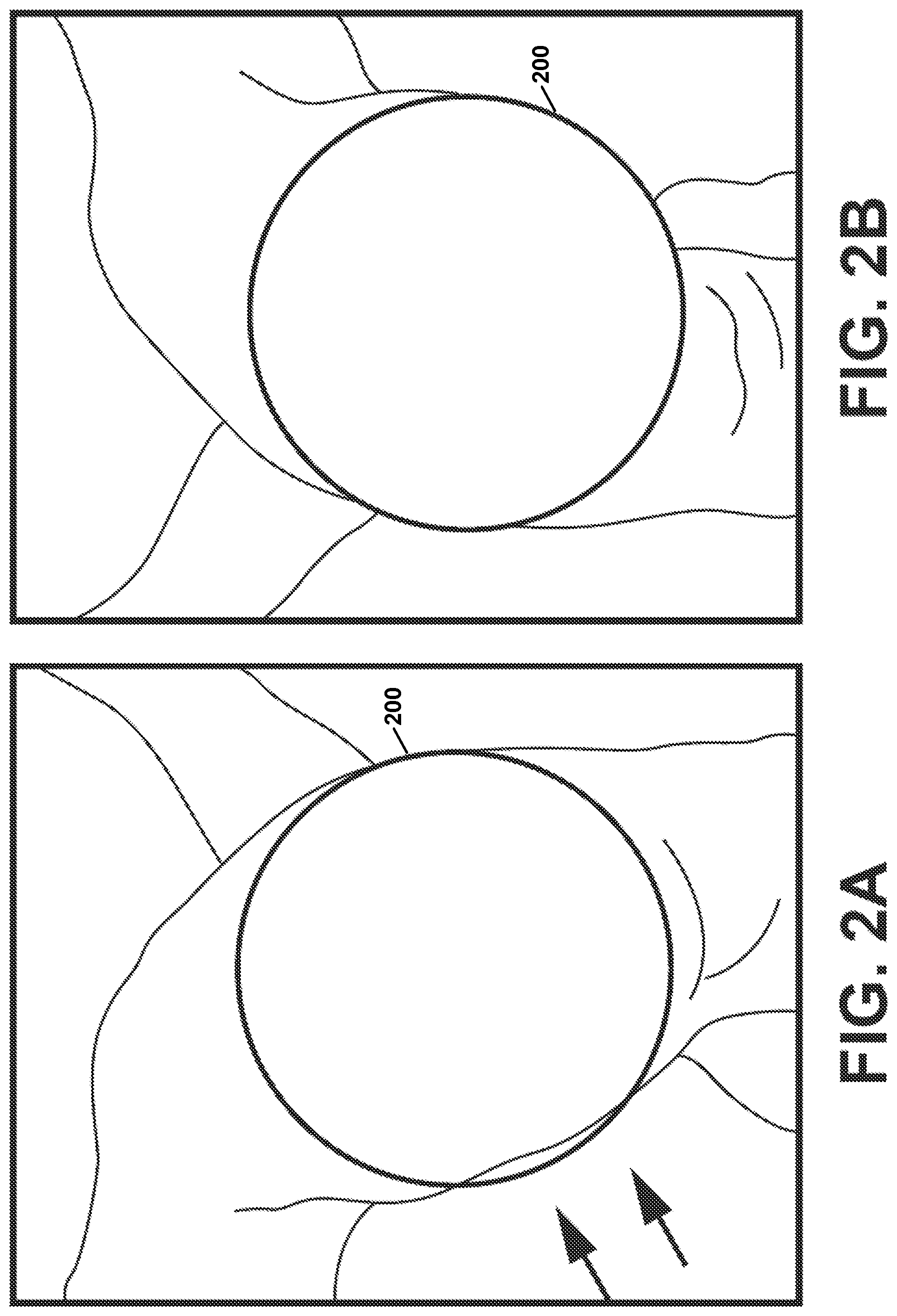 Patent US12303207 Figure 2 – Automated planning of shoulder stability enhancement surgeries