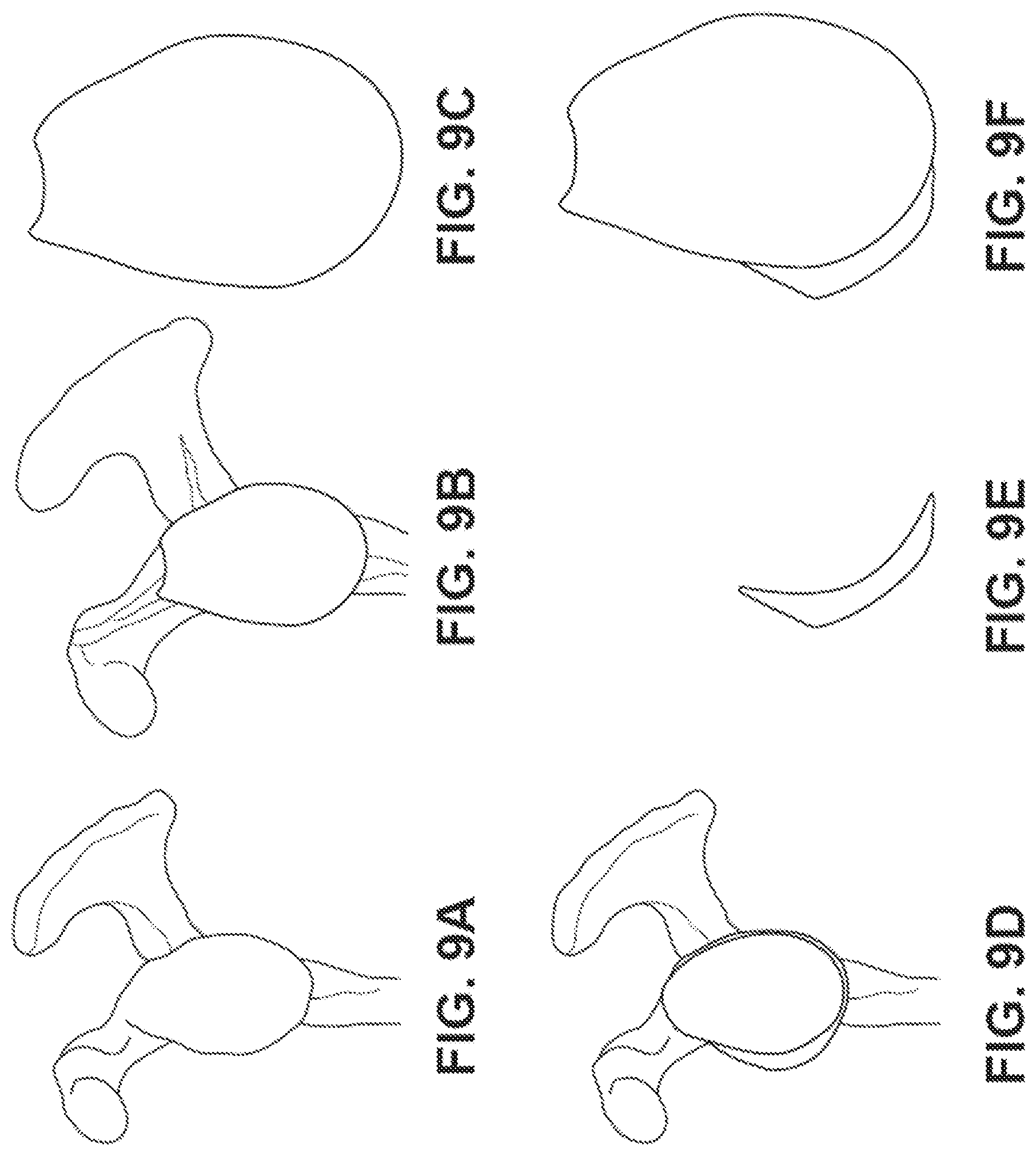 Patent US12303207 Figure 9 – Automated planning of shoulder stability enhancement surgeries