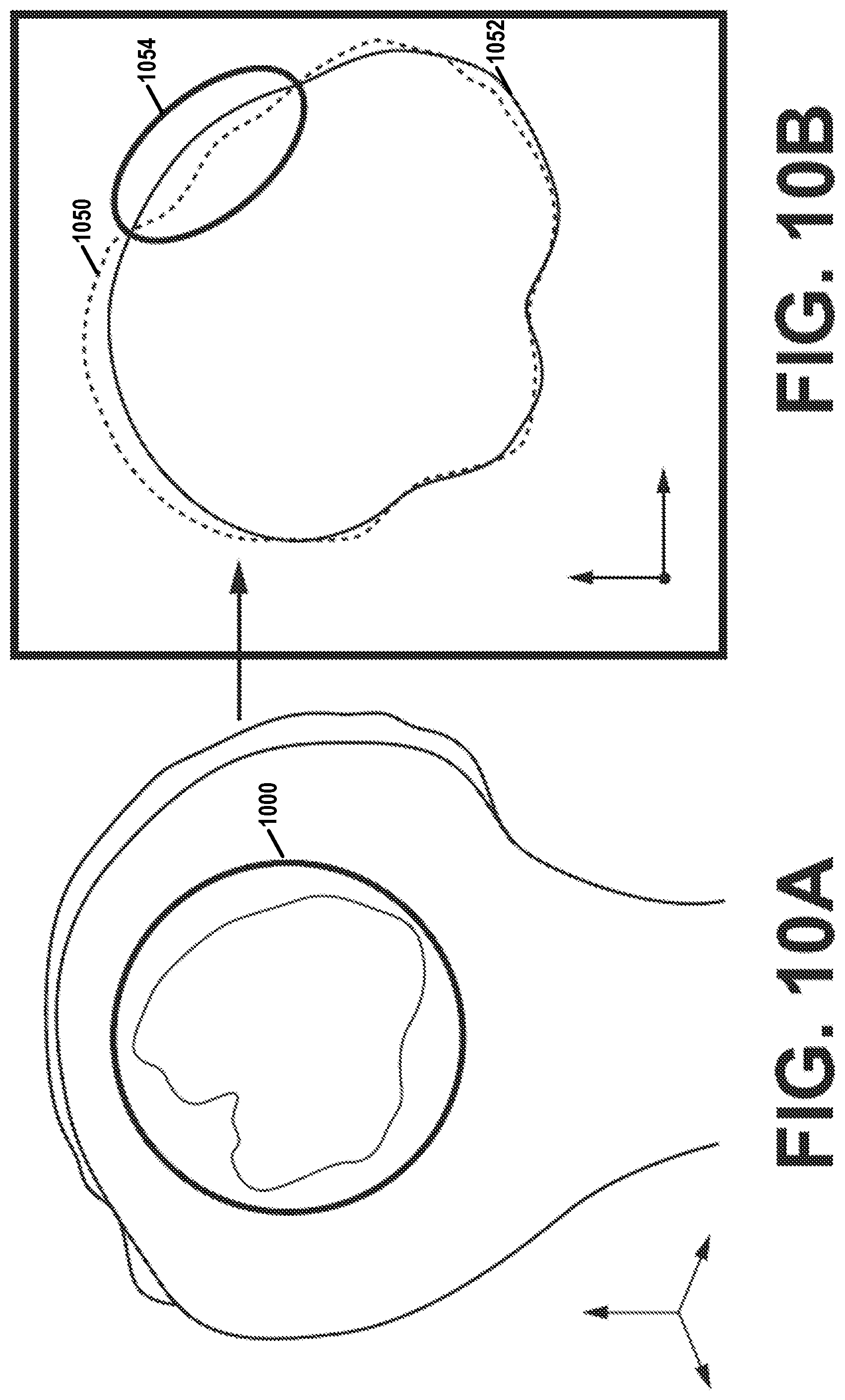 Patent US12303207 Figure 10 – Automated planning of shoulder stability enhancement surgeries