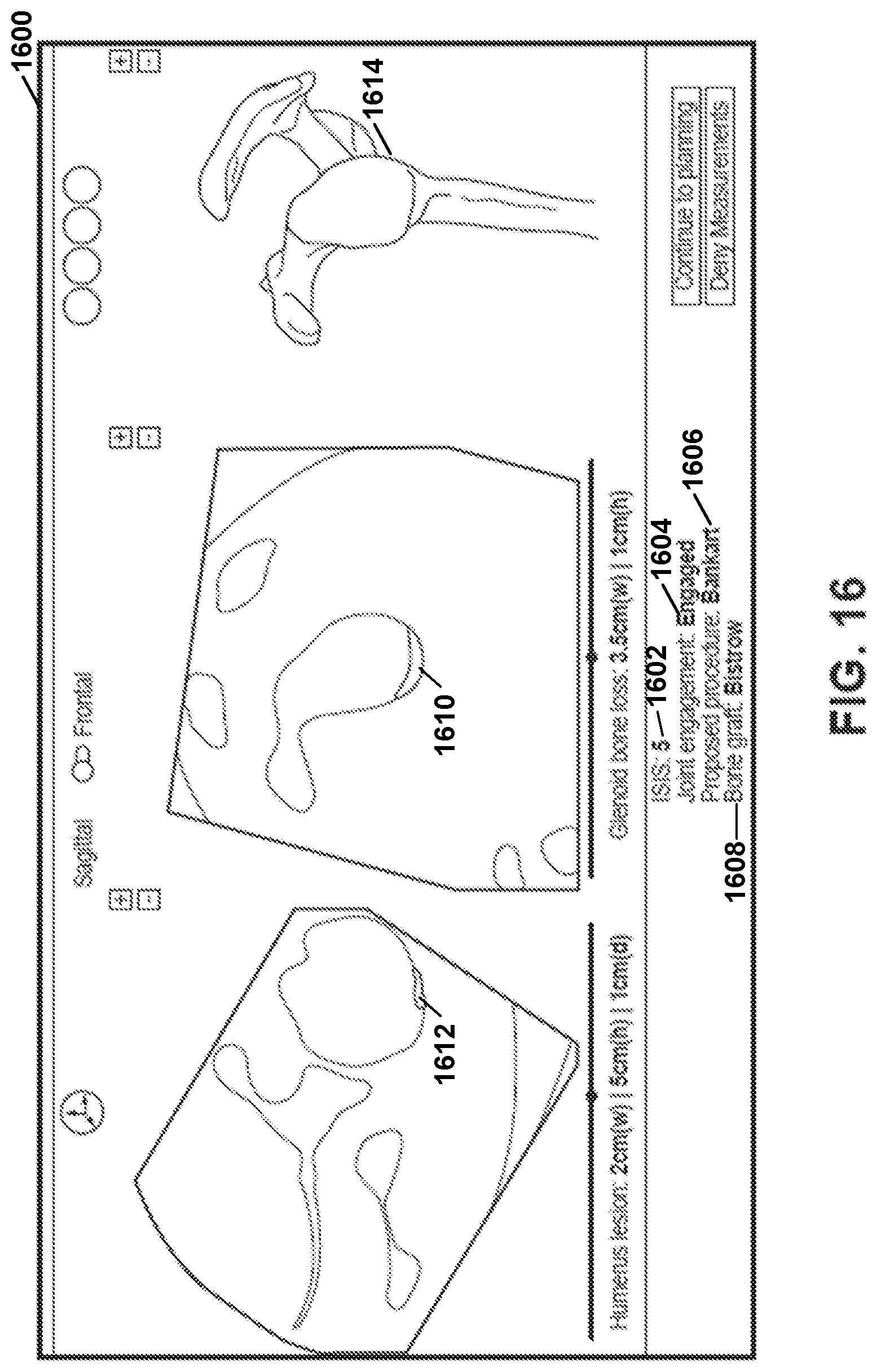 Patent US12303207 Figure 16 – Automated planning of shoulder stability enhancement surgeries