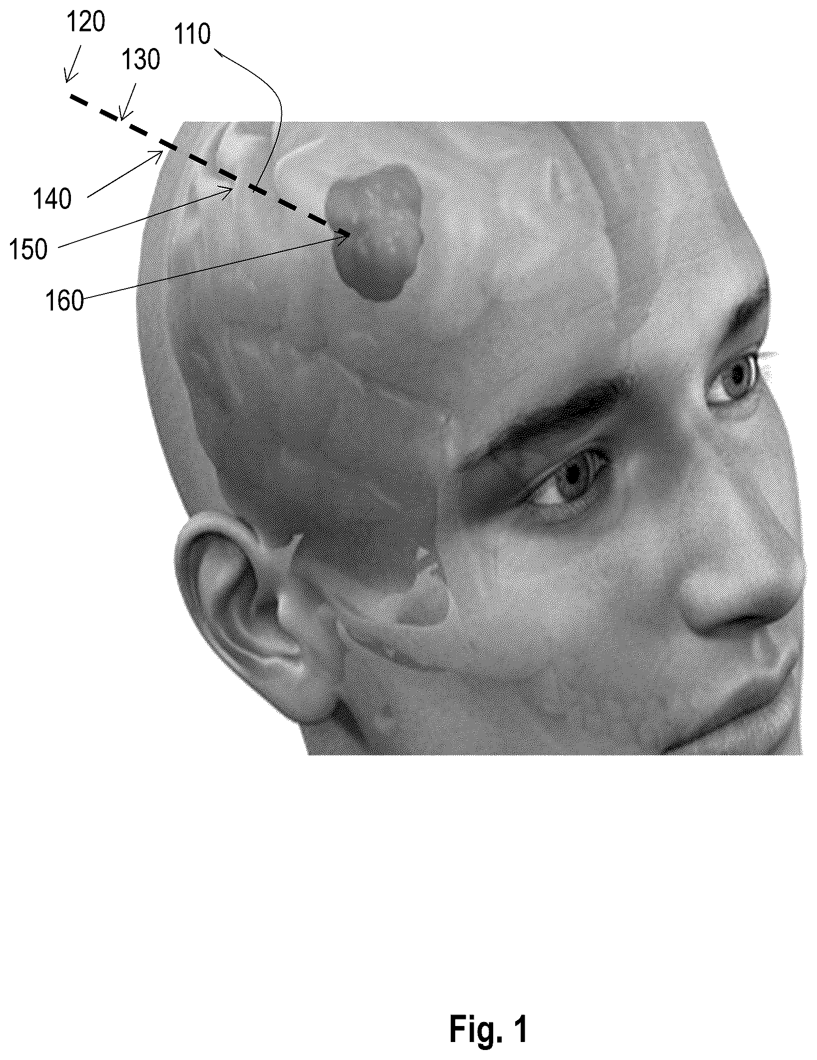 Patent US12303208 Figure 1 – Method and system to augment medical scan image information on extended reality image