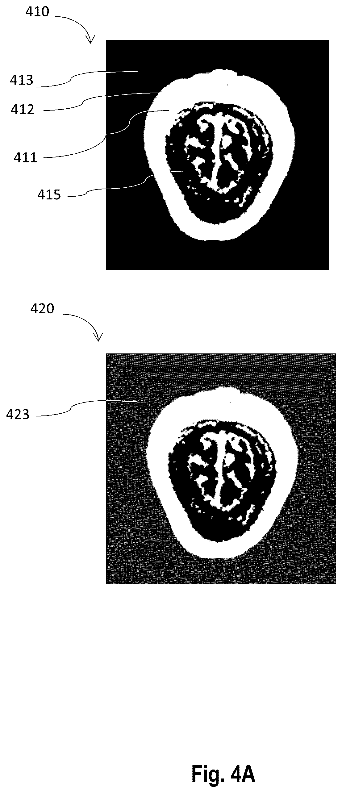 Patent US12303208 Figure 4 – Method and system to augment medical scan image information on extended reality image