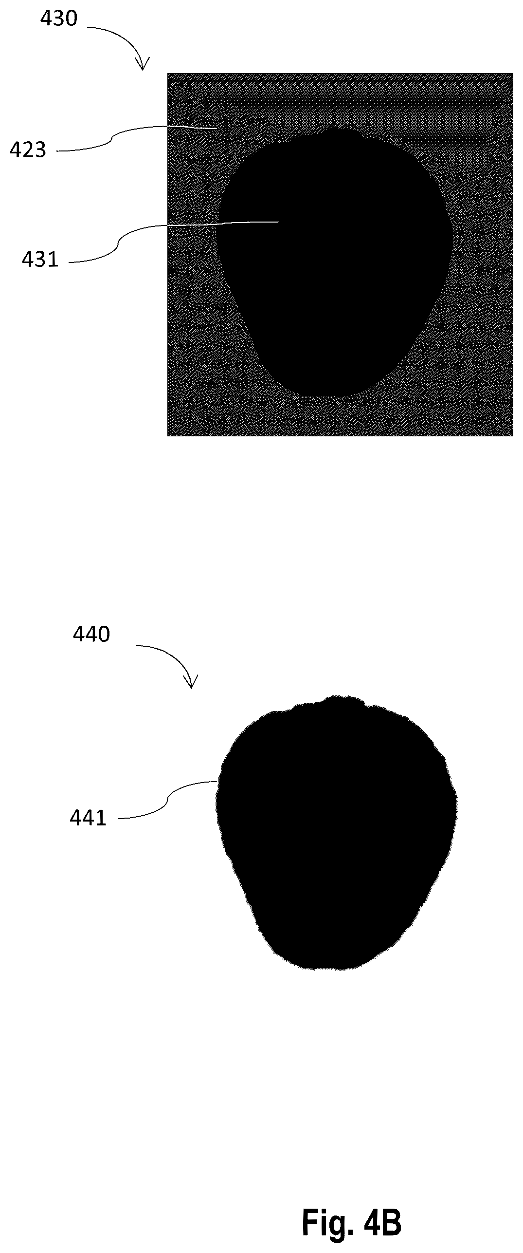 Patent US12303208 Figure 5 – Method and system to augment medical scan image information on extended reality image