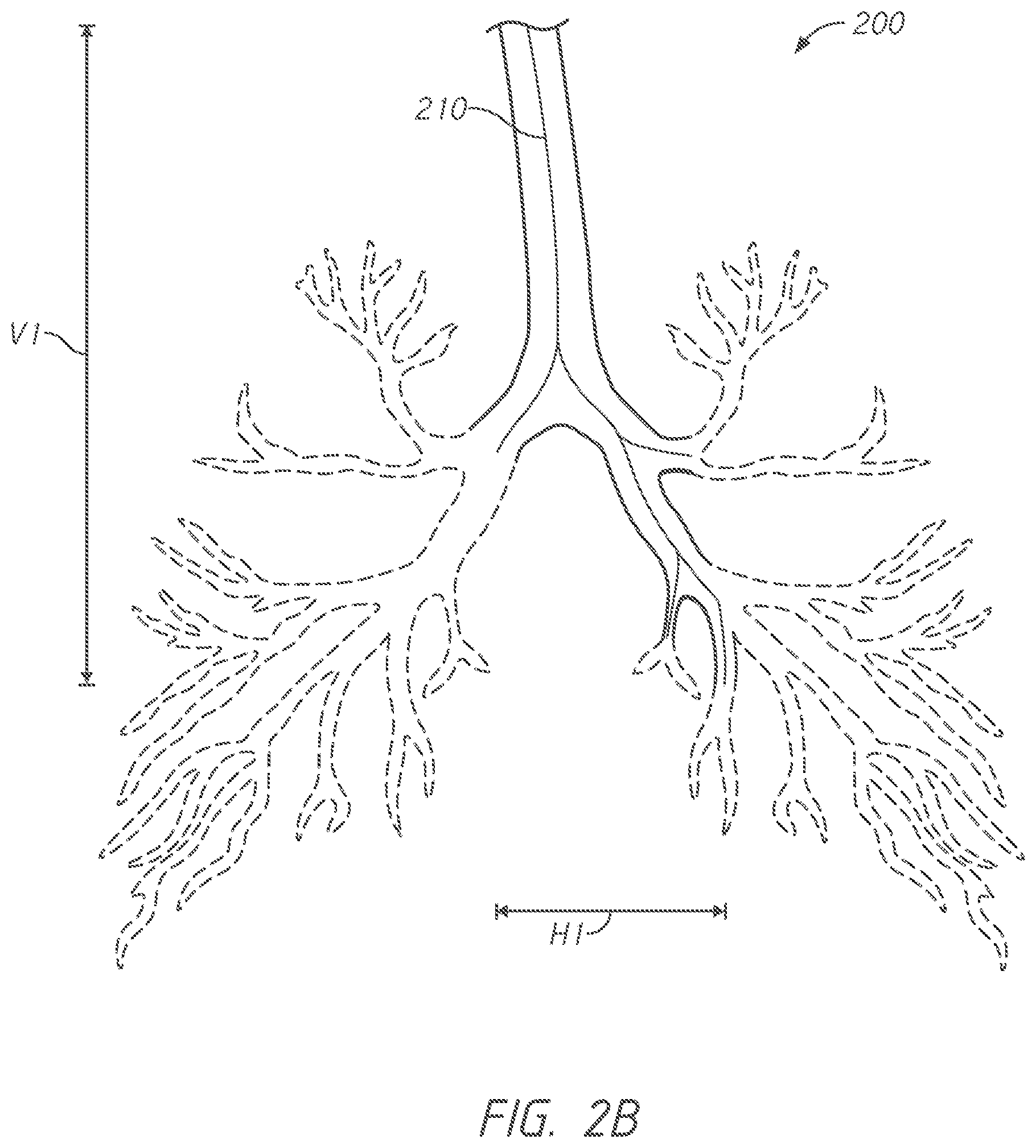 Patent US12303209 Figure 3 – Systems for evaluating registerability of anatomic models and associated methods