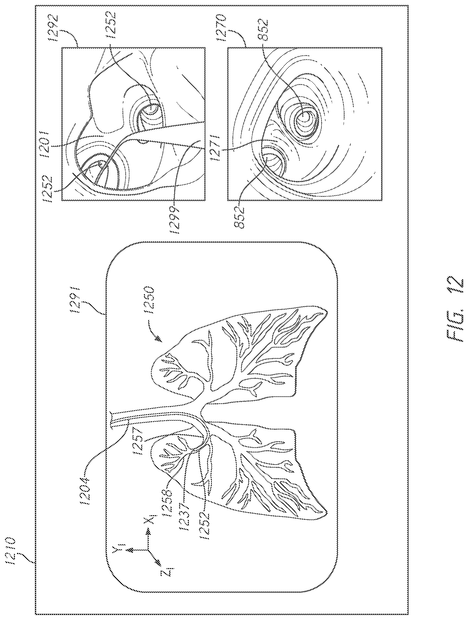 Patent US12303209 Figure 11 – Systems for evaluating registerability of anatomic models and associated methods