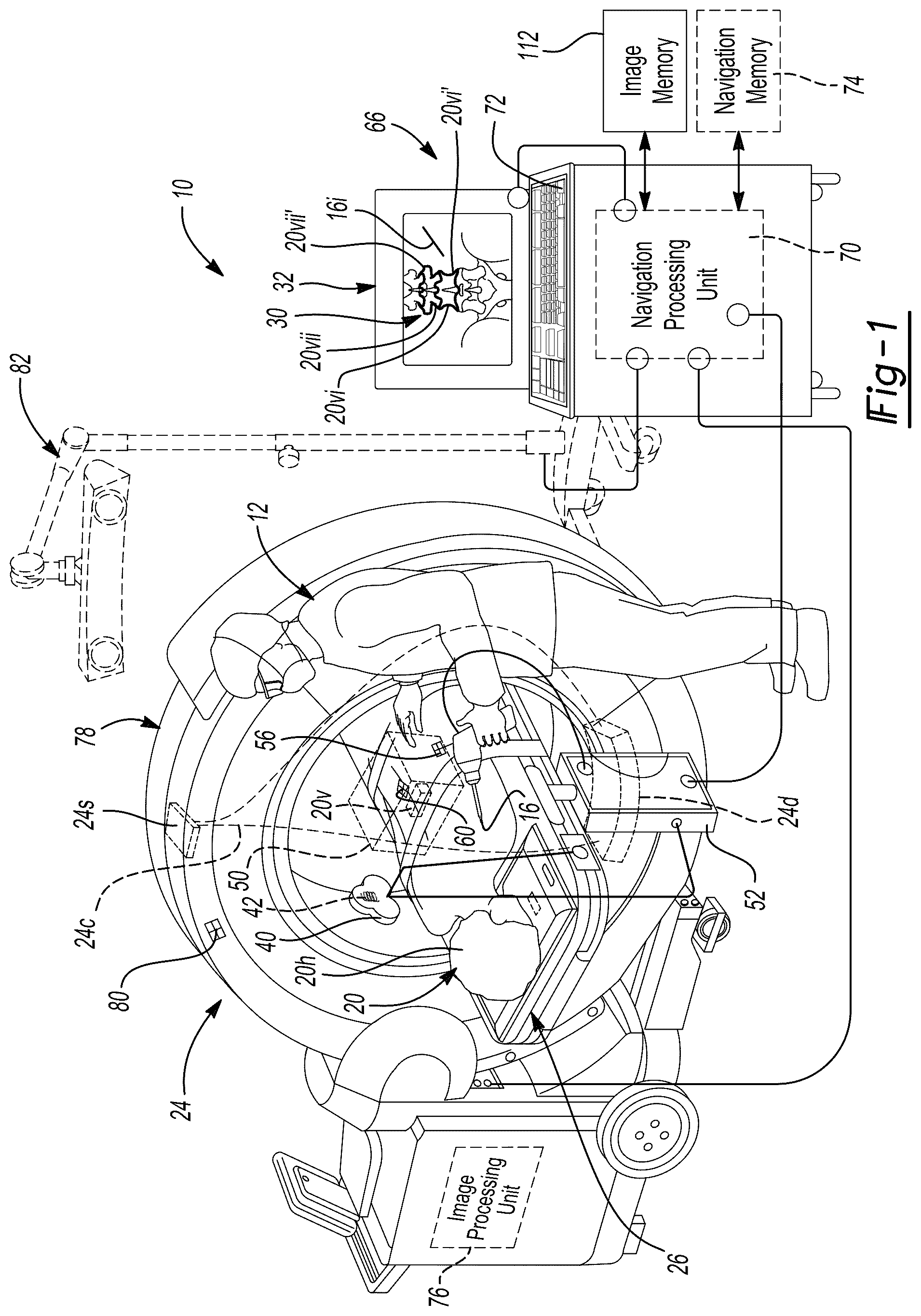 Patent US12303211 — System and method for a tracked procedure — Figure 1