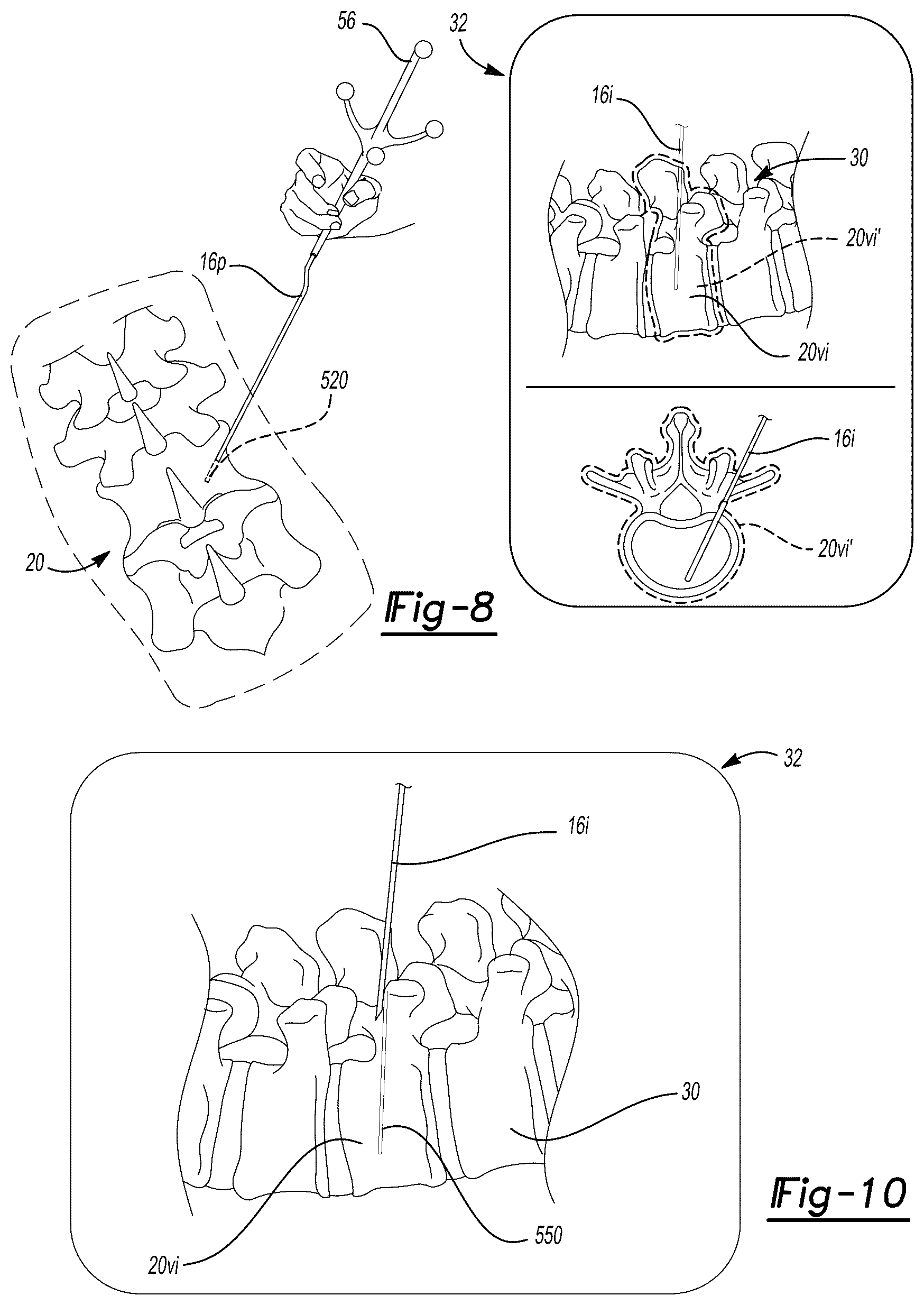 Patent US12303211 Figure 8 – System and method for a tracked procedure