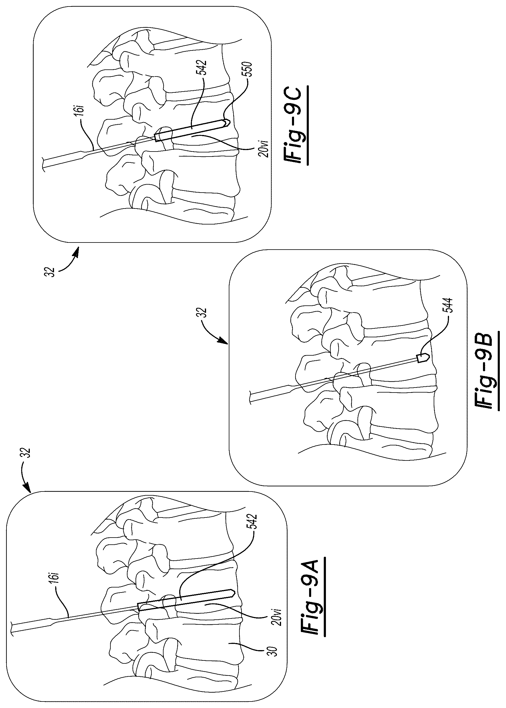Patent US12303211 Figure 9 – System and method for a tracked procedure
