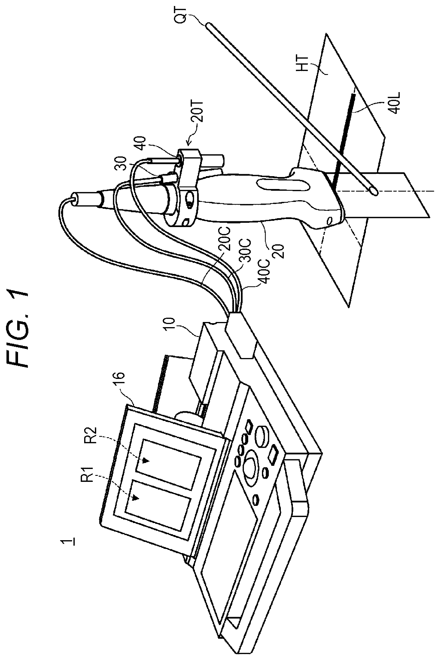 Patent US12303212 Figure 1 – Ultrasonic diagnostic apparatus, ultrasonic probe, and attachment for ultrasonic probe