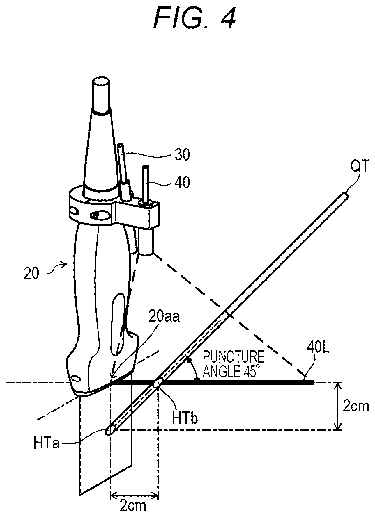 Patent US12303212 Figure 4 – Ultrasonic diagnostic apparatus, ultrasonic probe, and attachment for ultrasonic probe