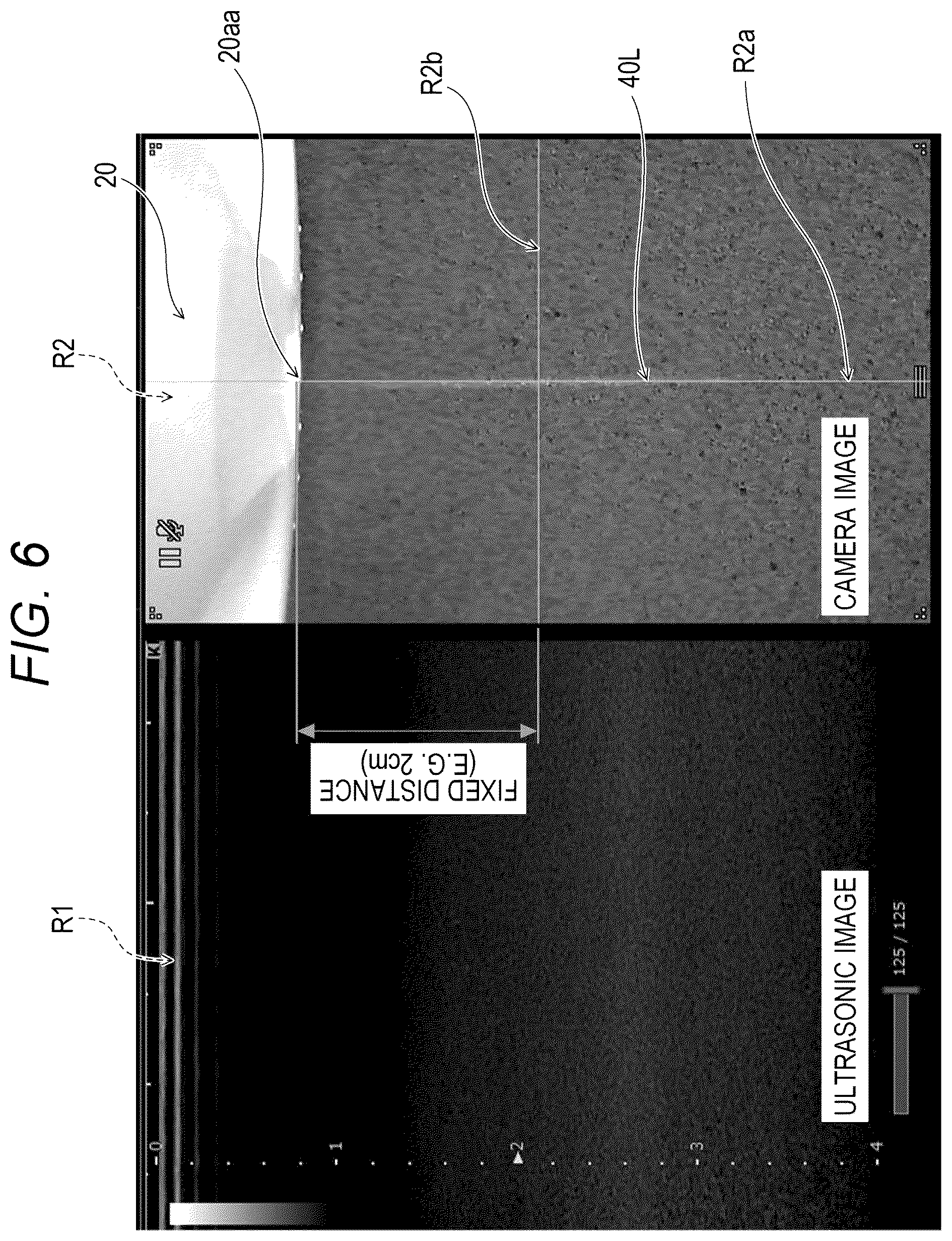 Patent US12303212 Figure 6 – Ultrasonic diagnostic apparatus, ultrasonic probe, and attachment for ultrasonic probe
