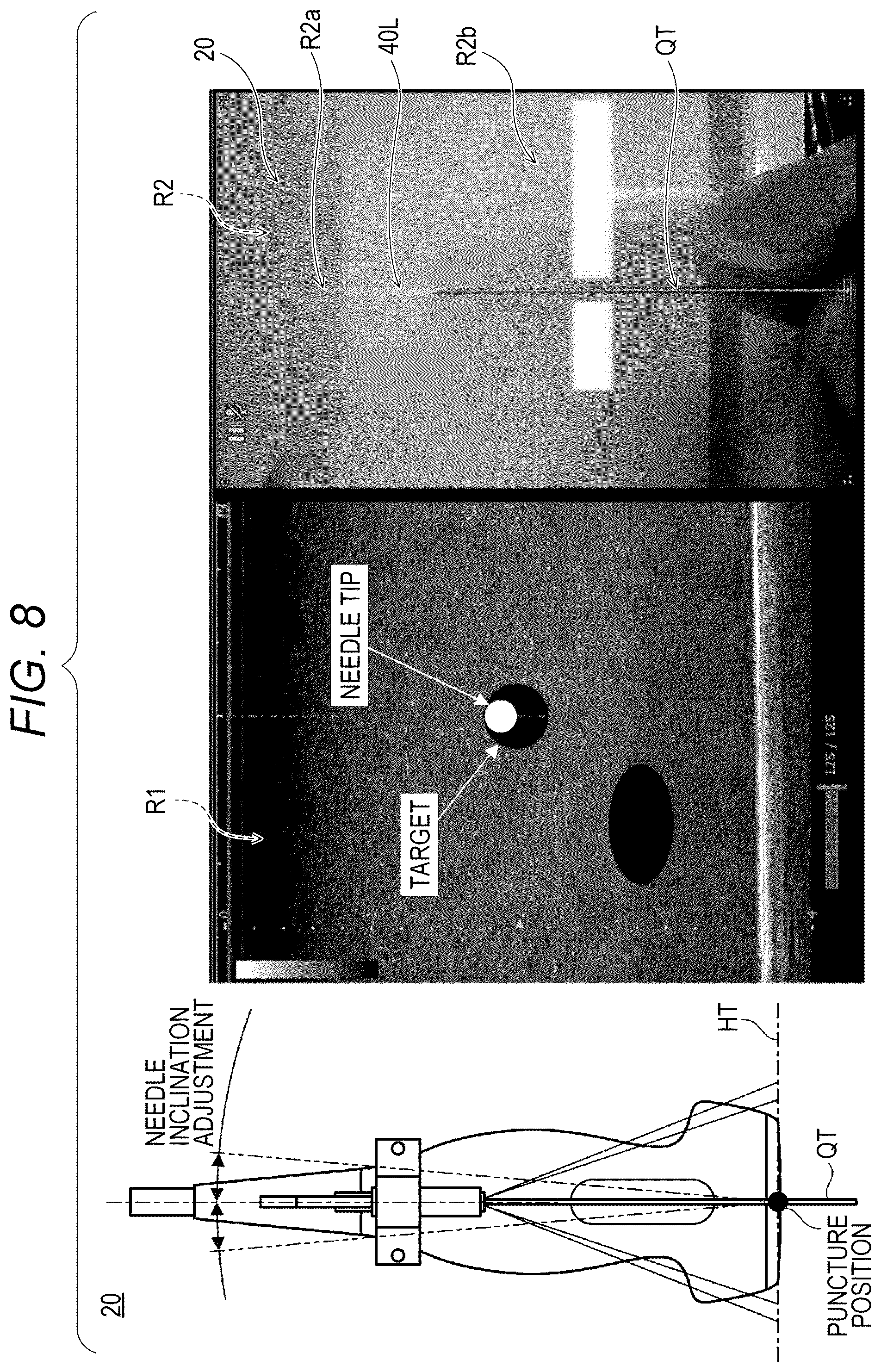 Patent US12303212 Figure 8 – Ultrasonic diagnostic apparatus, ultrasonic probe, and attachment for ultrasonic probe