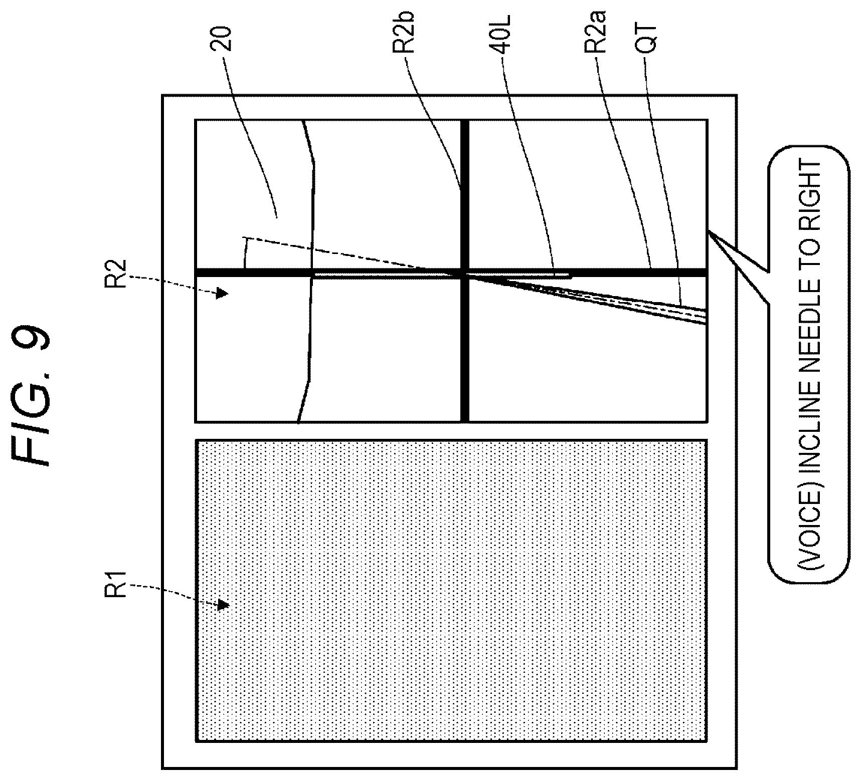 Patent US12303212 Figure 9 – Ultrasonic diagnostic apparatus, ultrasonic probe, and attachment for ultrasonic probe