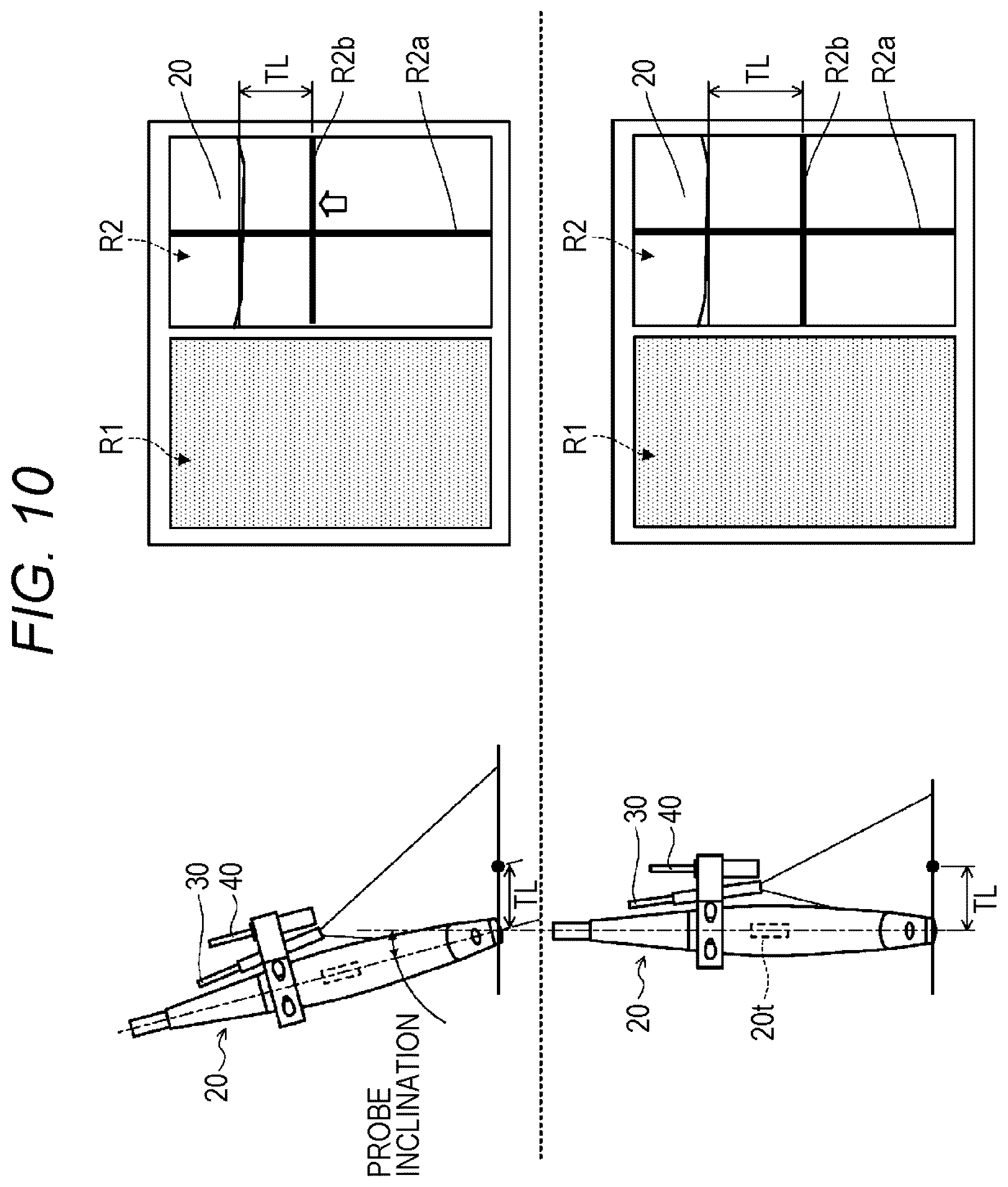 Patent US12303212 Figure 10 – Ultrasonic diagnostic apparatus, ultrasonic probe, and attachment for ultrasonic probe