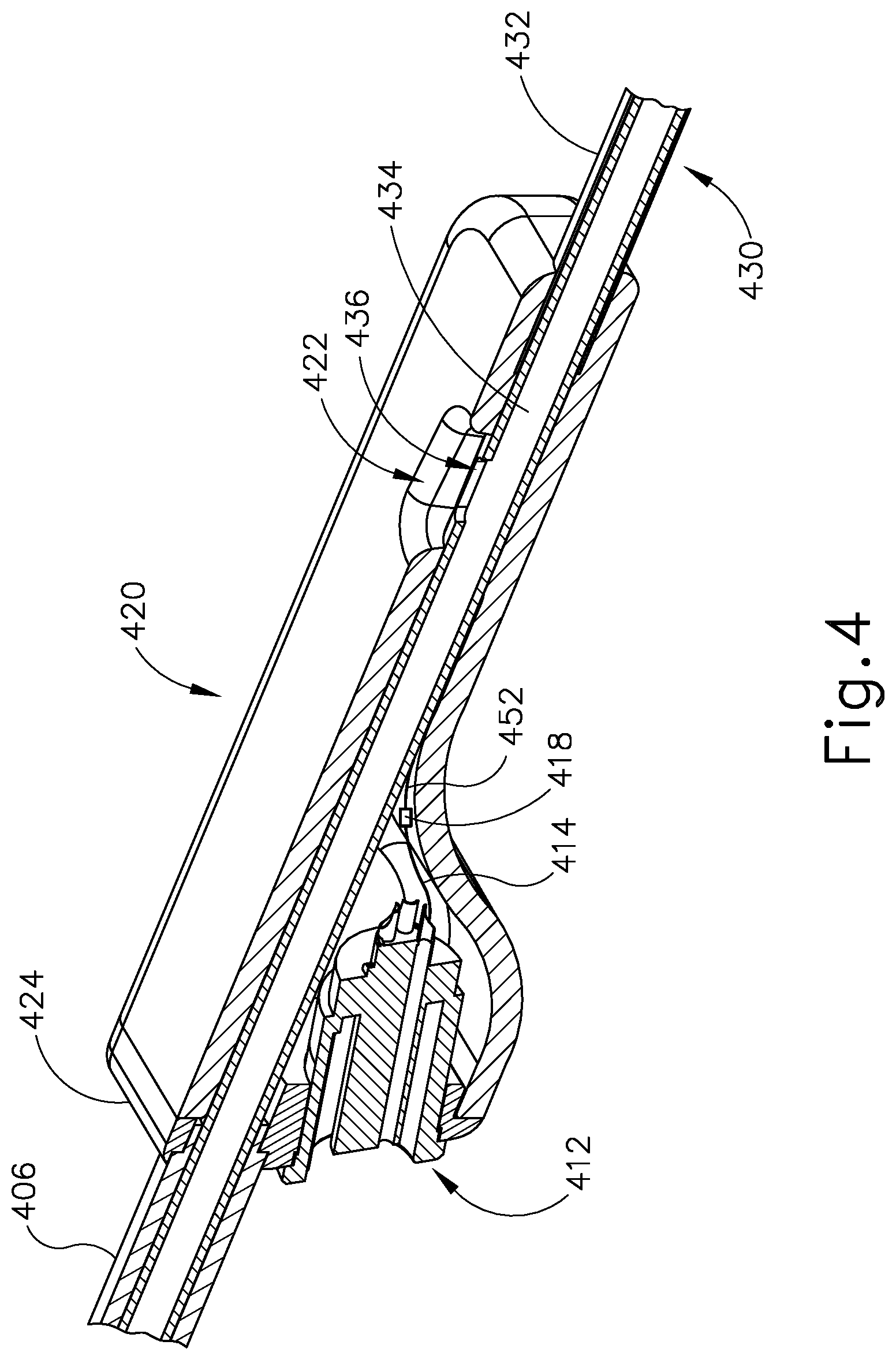Patent US12303215 Figure 4 – Curette with navigation sensor