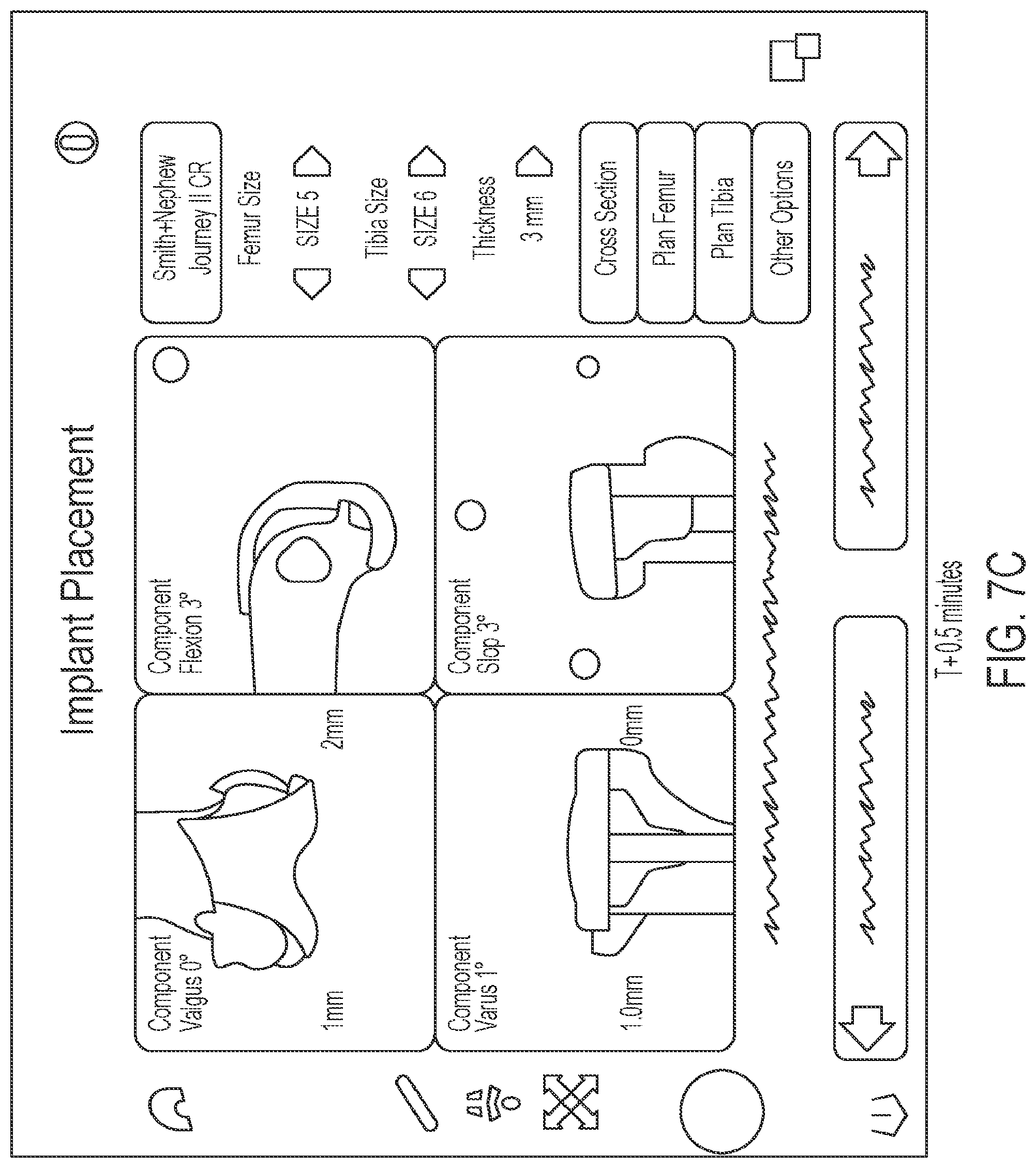 Patent US12303216 Figure 11 – Surgical tracking methods and fiber optic shape sensing devices thereof