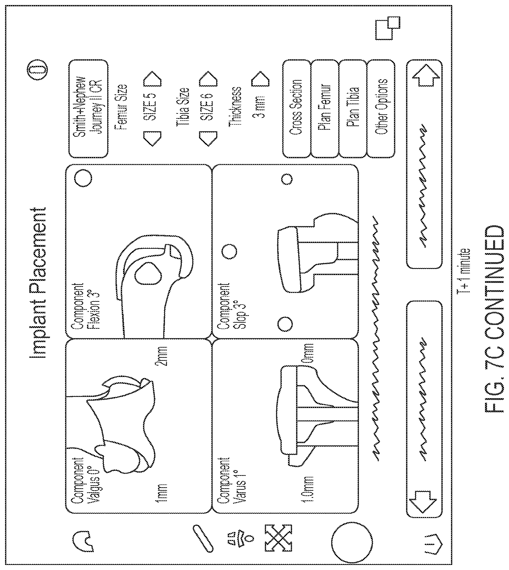 Patent US12303216 Figure 12 – Surgical tracking methods and fiber optic shape sensing devices thereof